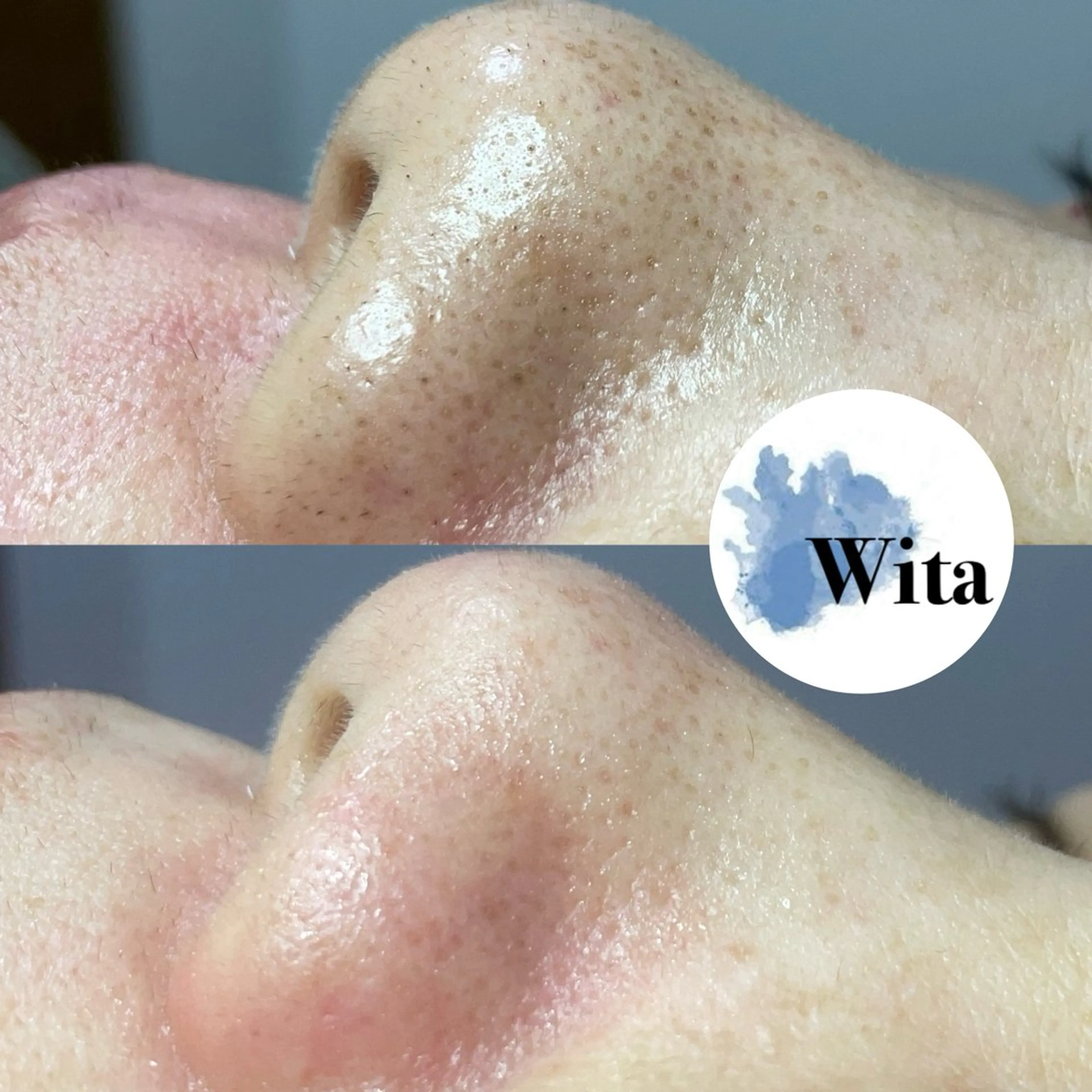 エステ Wita   aesthetic×eyelash所属・上坂 祐以のエステ・リラクイメージ