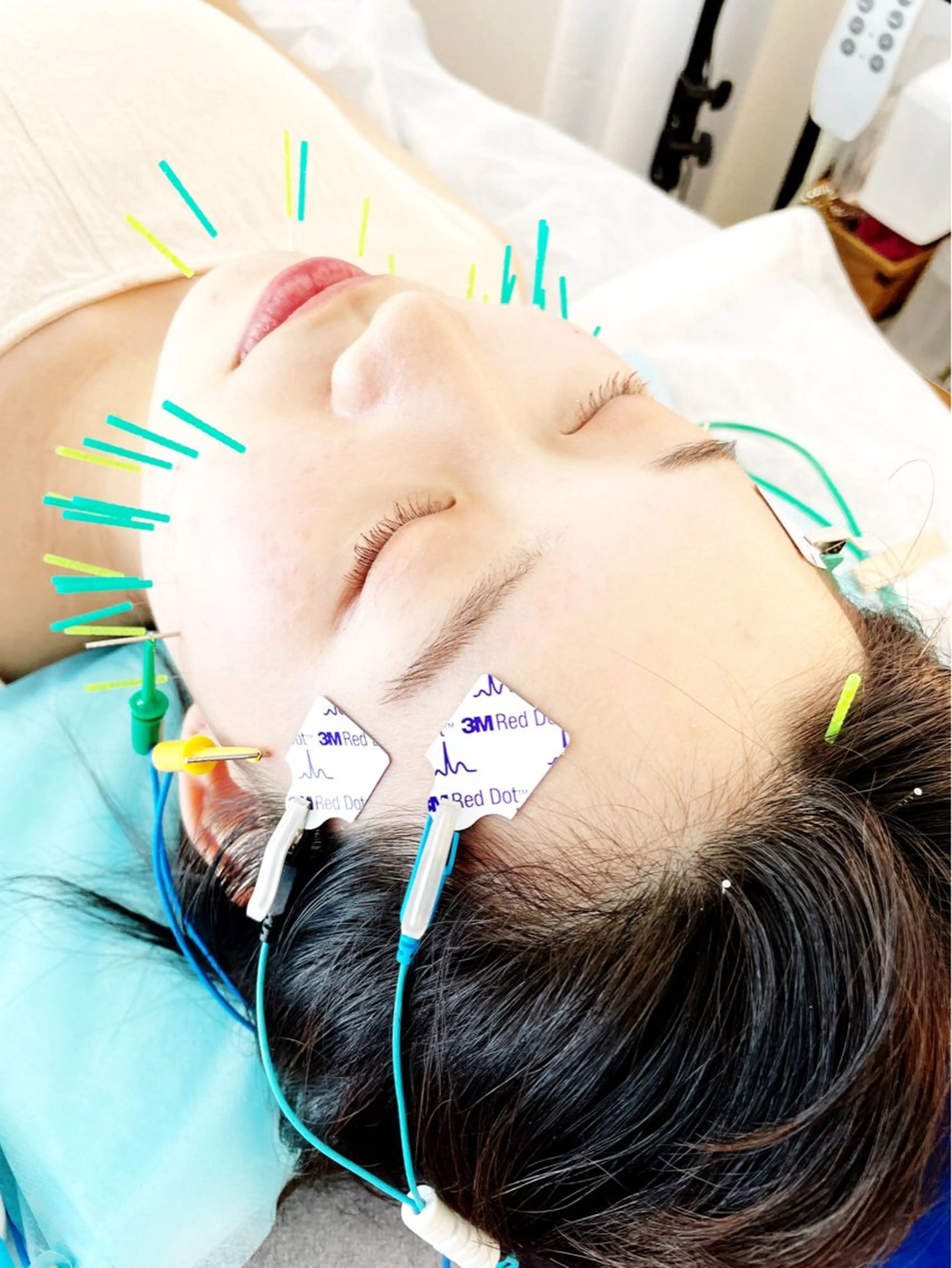 エステ リラク 小顔美容鍼専門サロン 渋谷YZのエステ・リラクイメージ