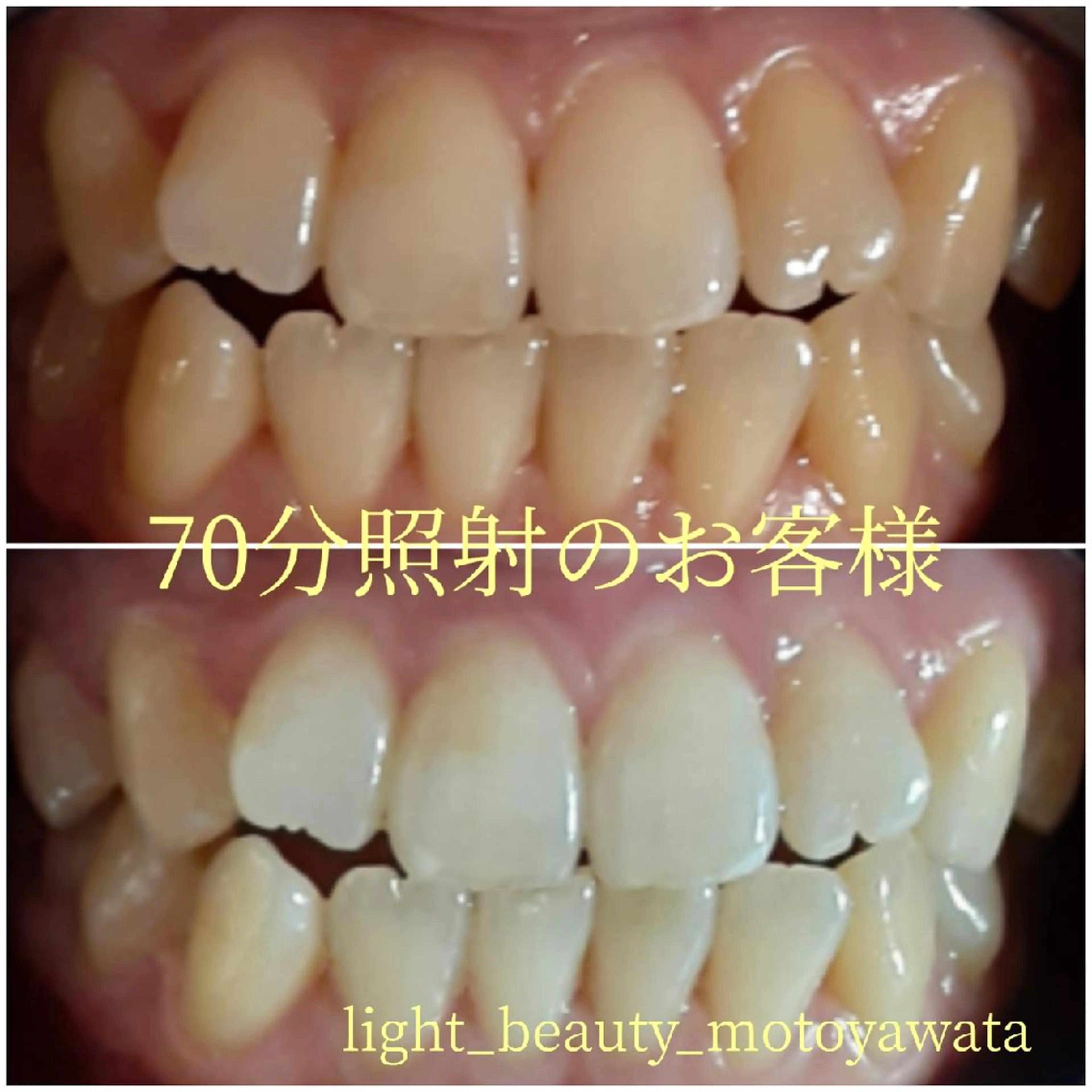 その他 五十嵐 蓮のその他イメージ