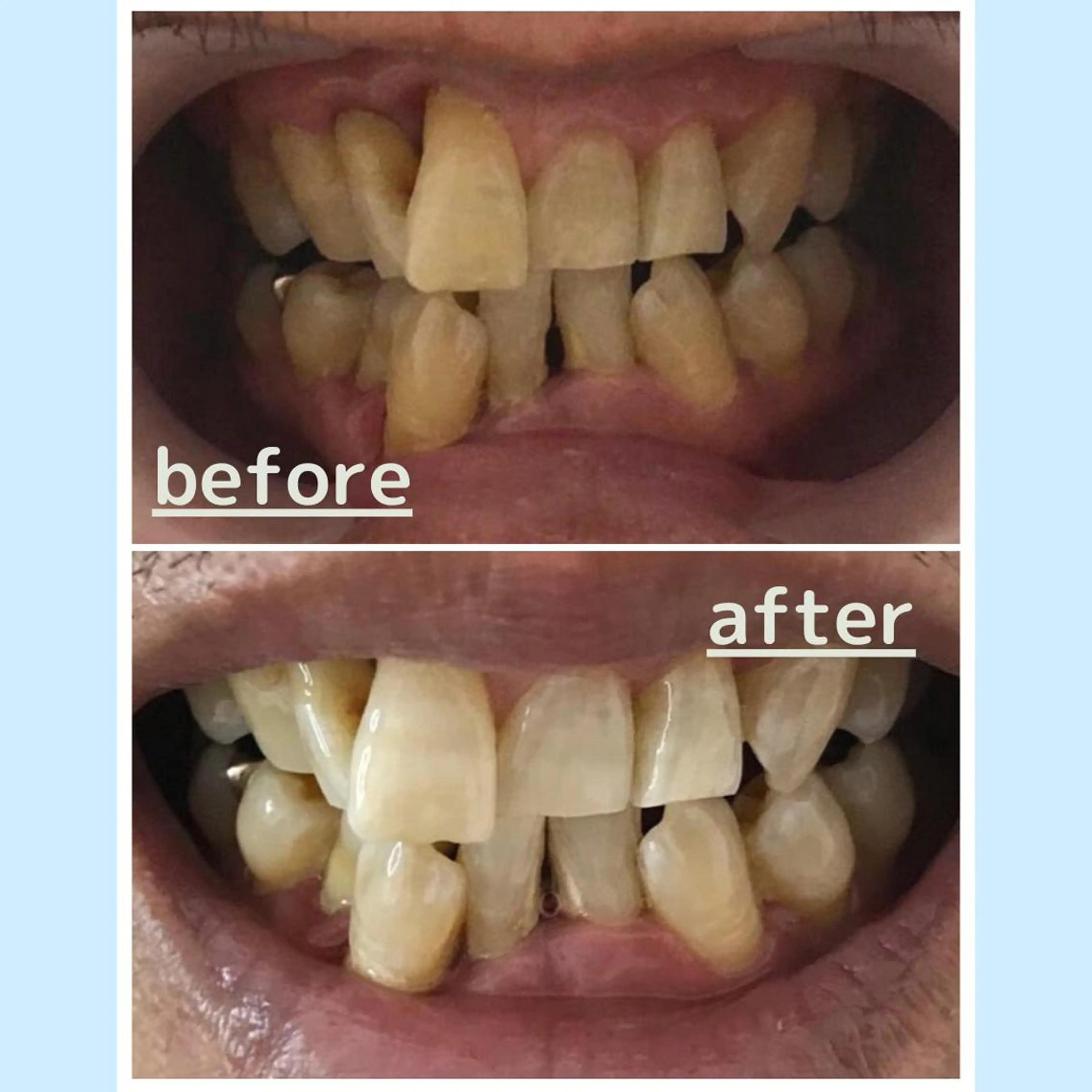 メンズ お手軽ホワイトニングsalon mina所属・武元 奈津美のその他イメージ