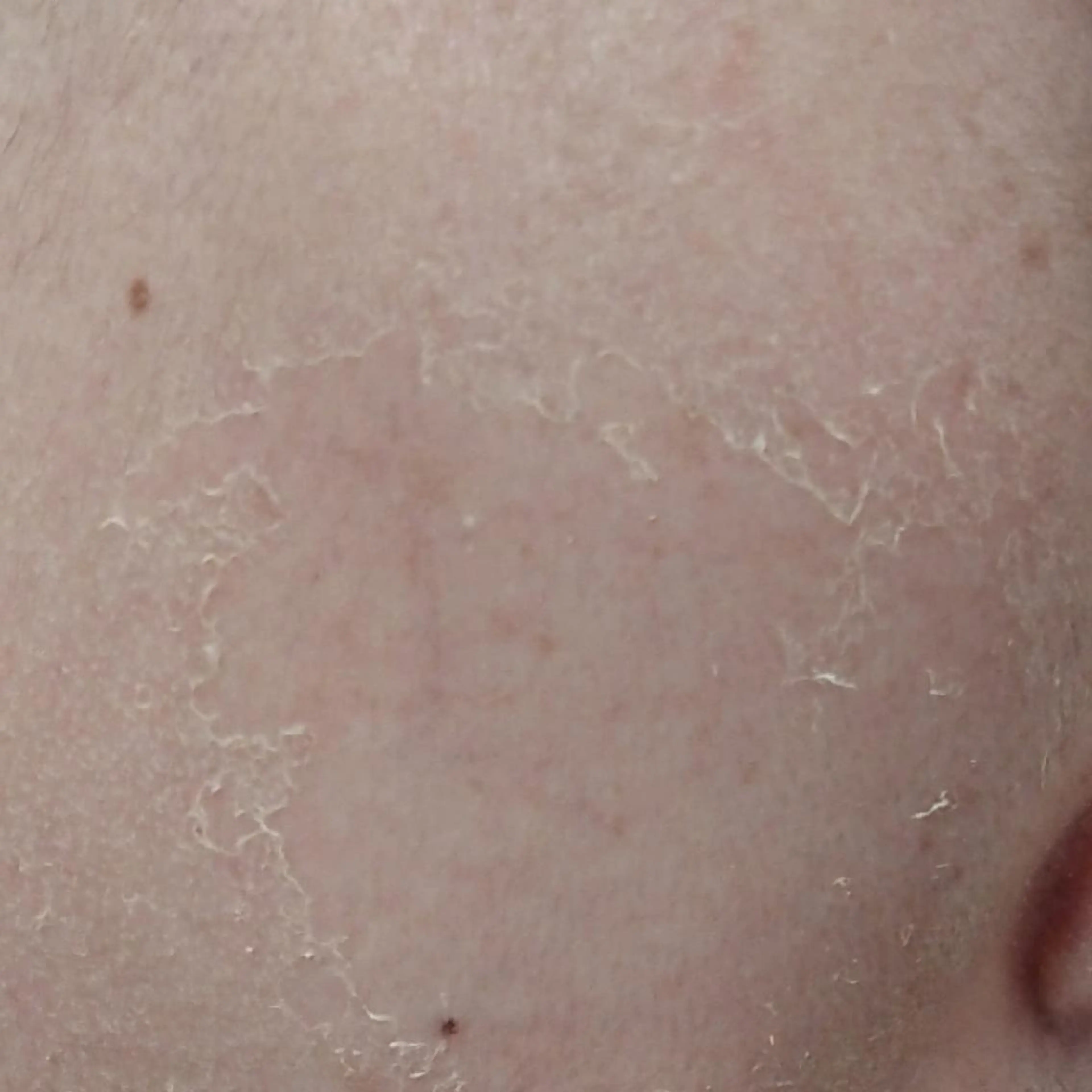 小顔と腸の専門店 ラクーラビューティのエステ・リラクイメージ