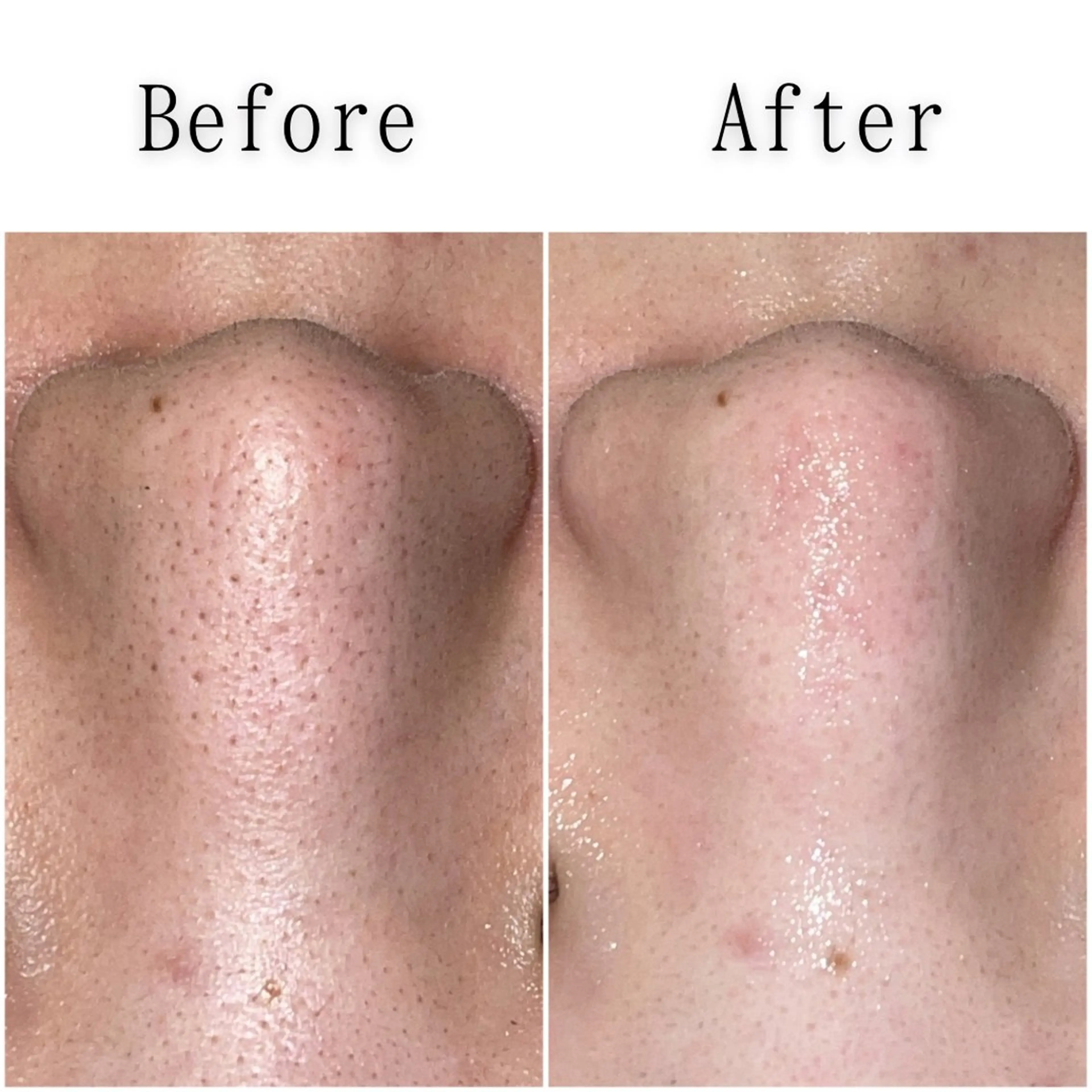 エステ SELF  BEAUTY gracia浦添店所属・gracia 浦添店のその他イメージ