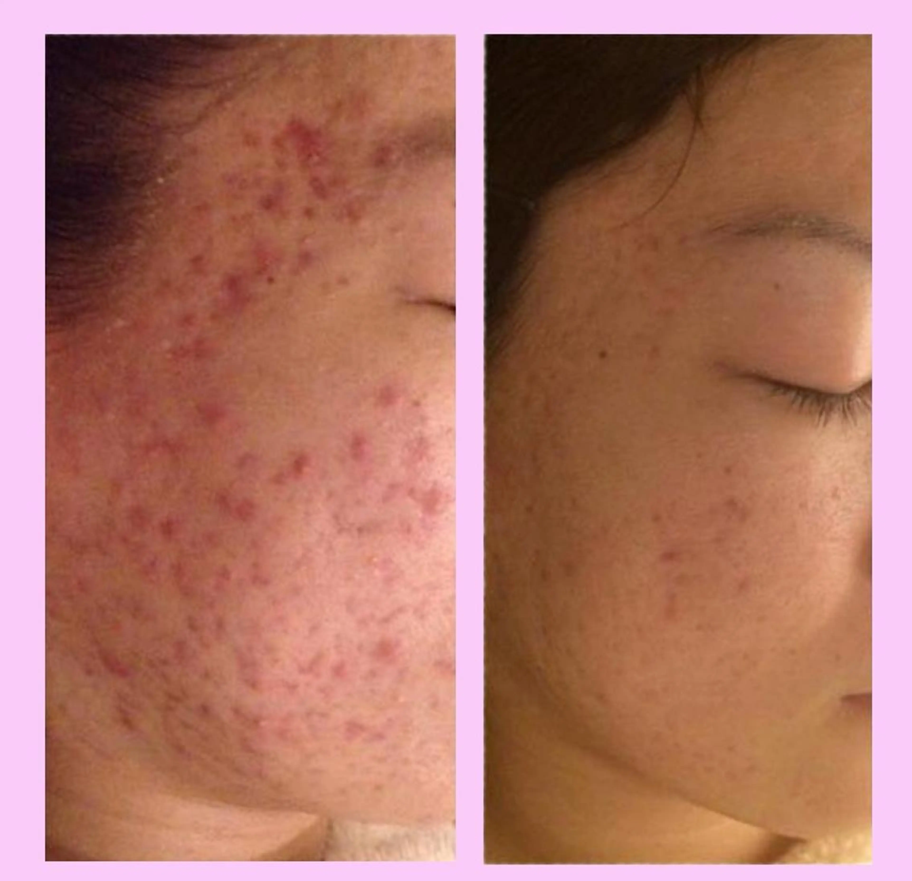 エステ リラク HARIS(ハリス) 院長Shimのエステ・リラクイメージ