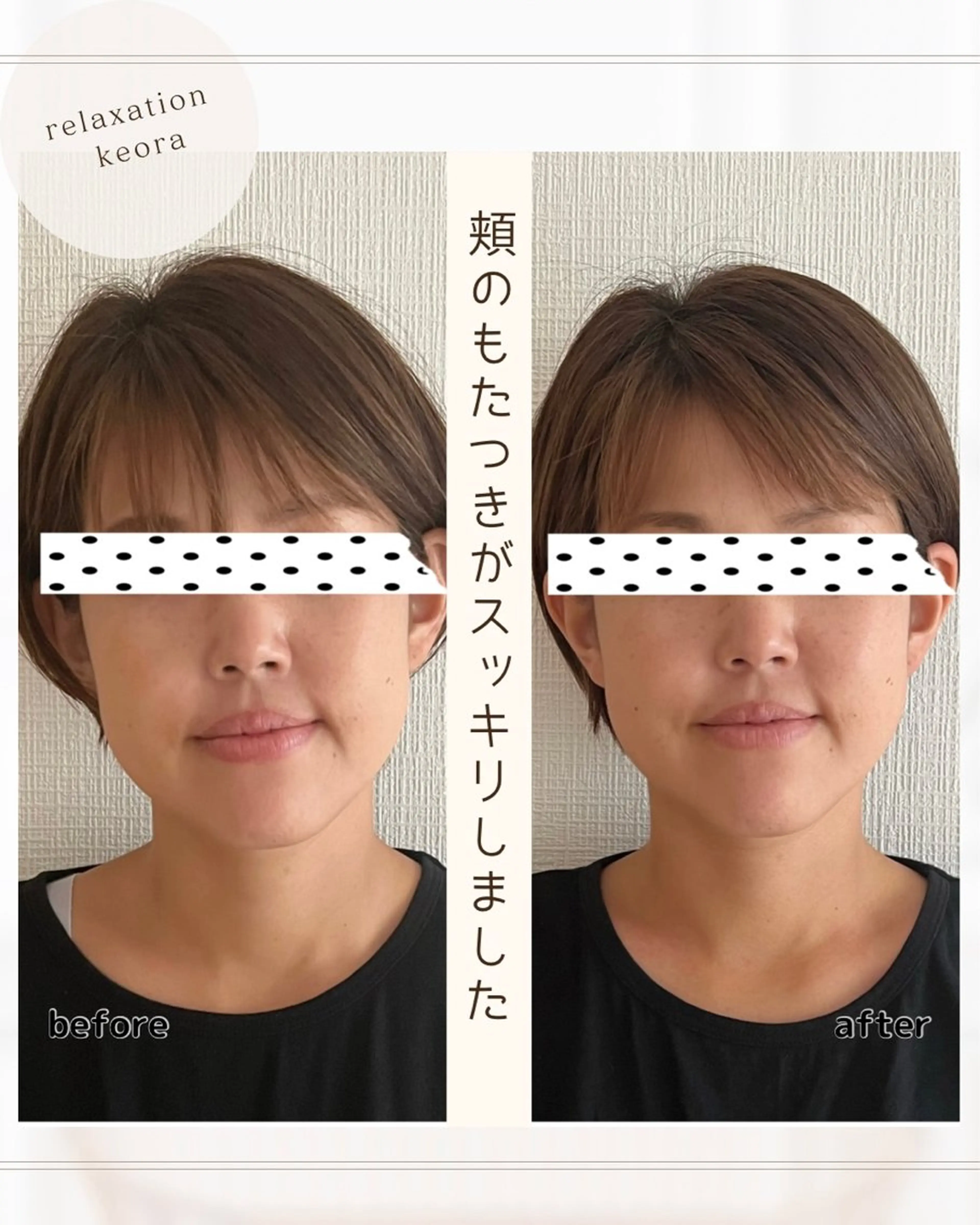 【小顔矯正】90分　エラ 頬骨 むくみ⁂特殊な技術でスッキリ改善！症状が軽い方＊まずはお試し◎の写真