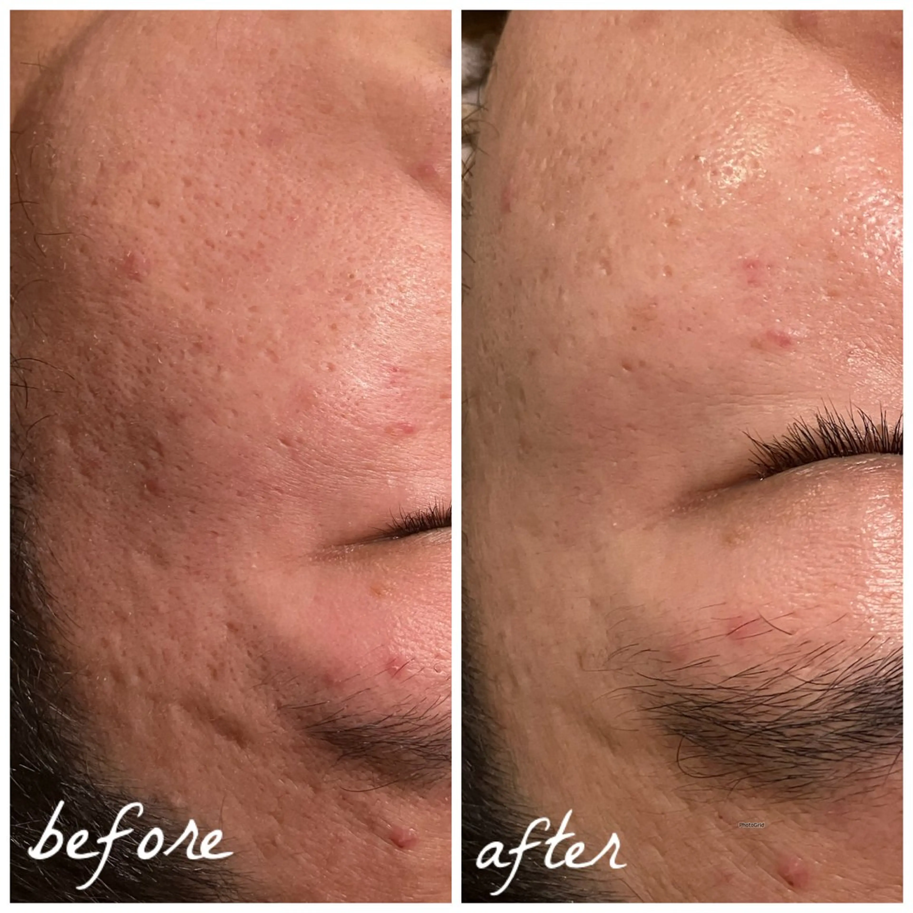 メンズ メナード岐阜茜部 杉浦のエステ・リラクイメージ