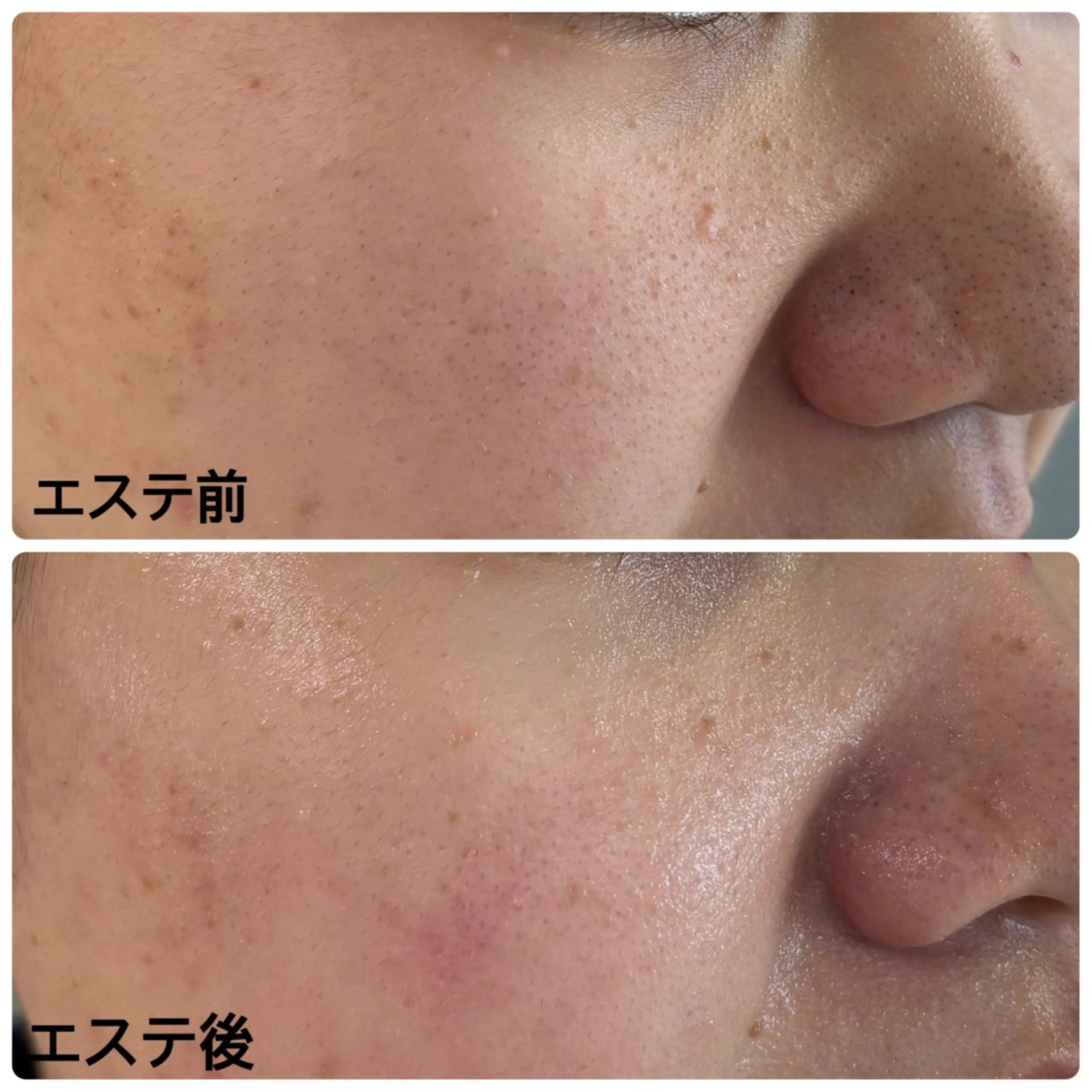 エステ リラク デアイム石岡所属・網代 綾美のエステ・リラクイメージ