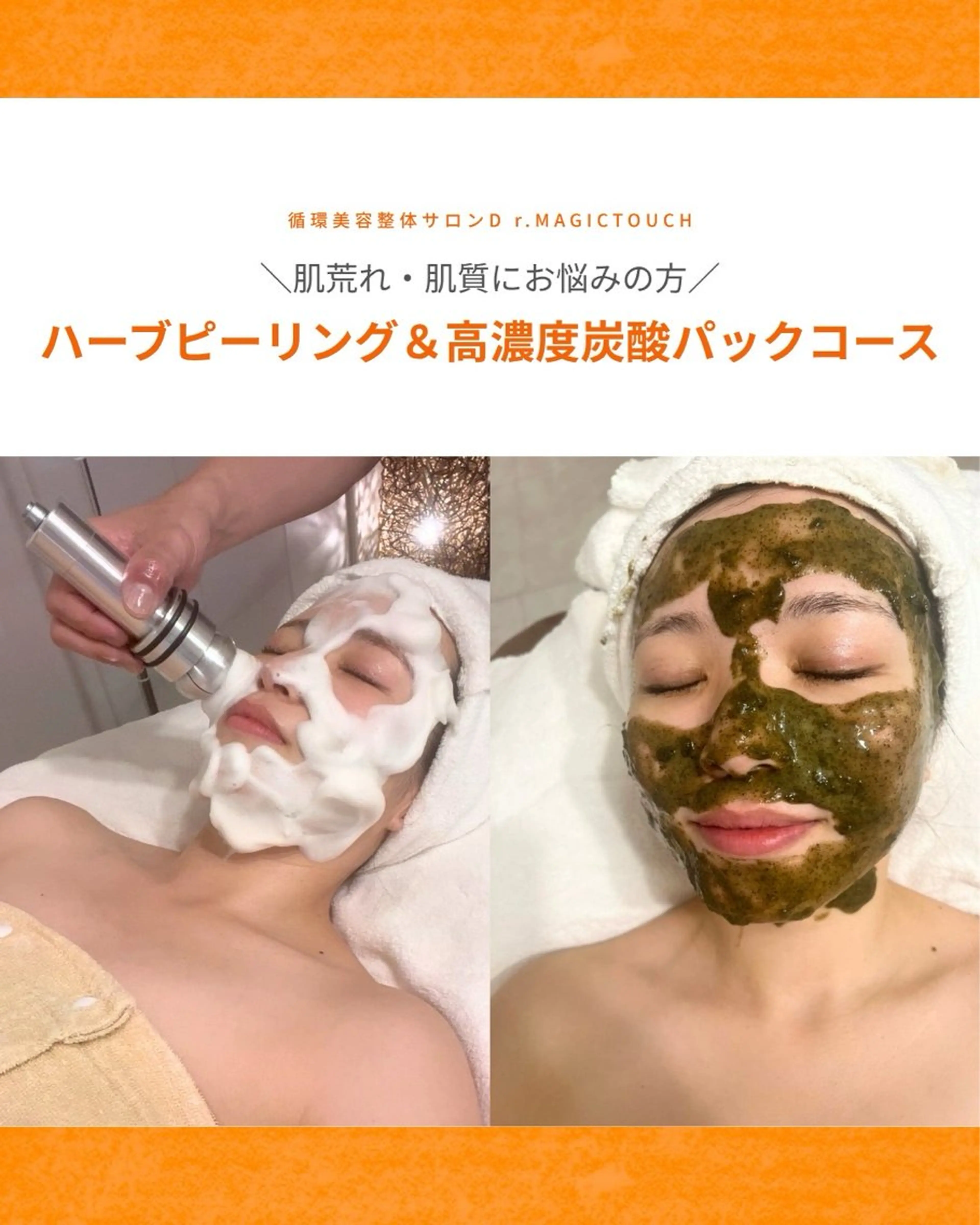 【凸凹肌・ニキビ肌•クスミ肌にお悩みの方】ハーブピーリング＆高濃度炭酸パックコースの写真