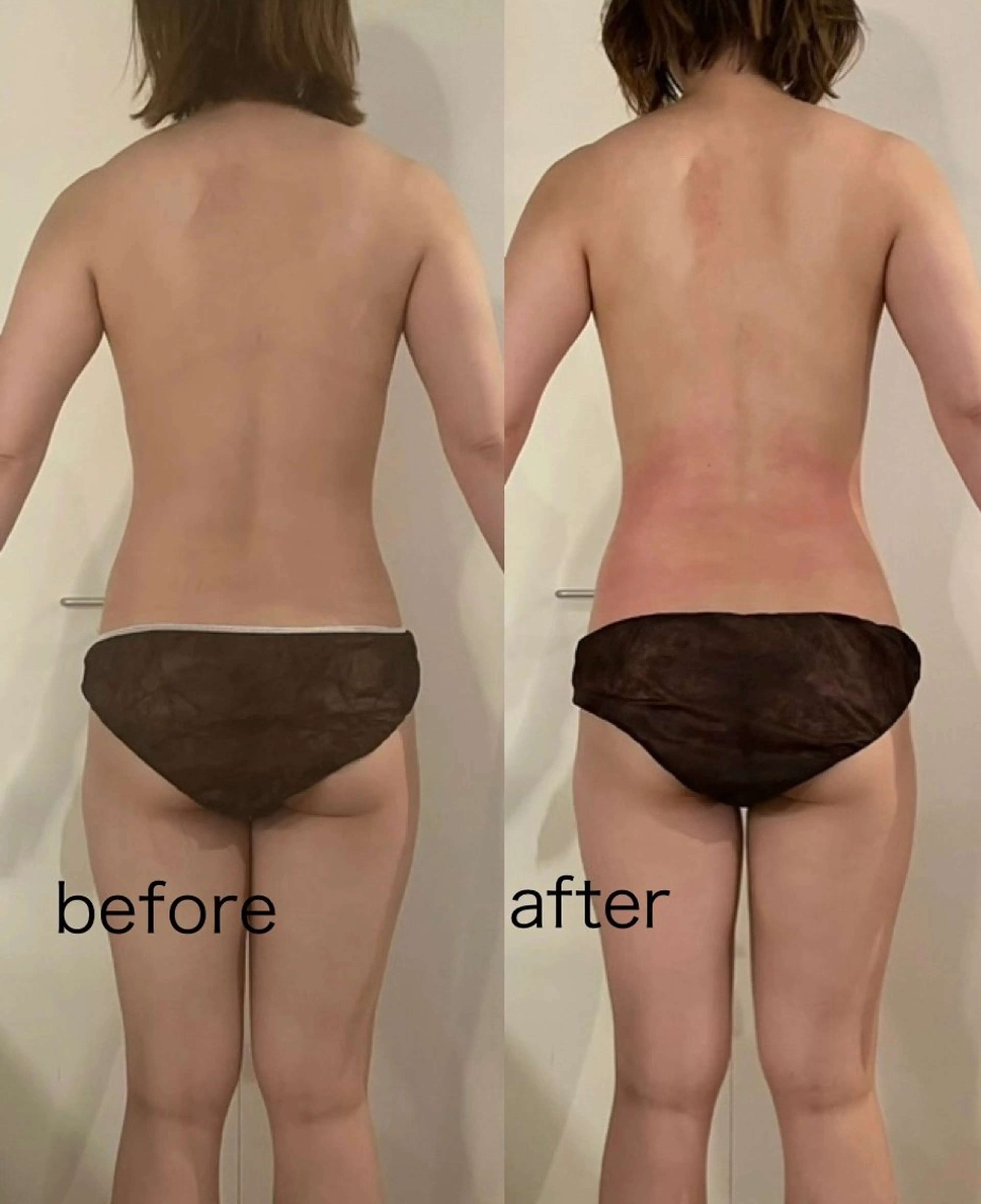 エステ リラク プライベートサロン シュシュのエステ・リラクイメージ