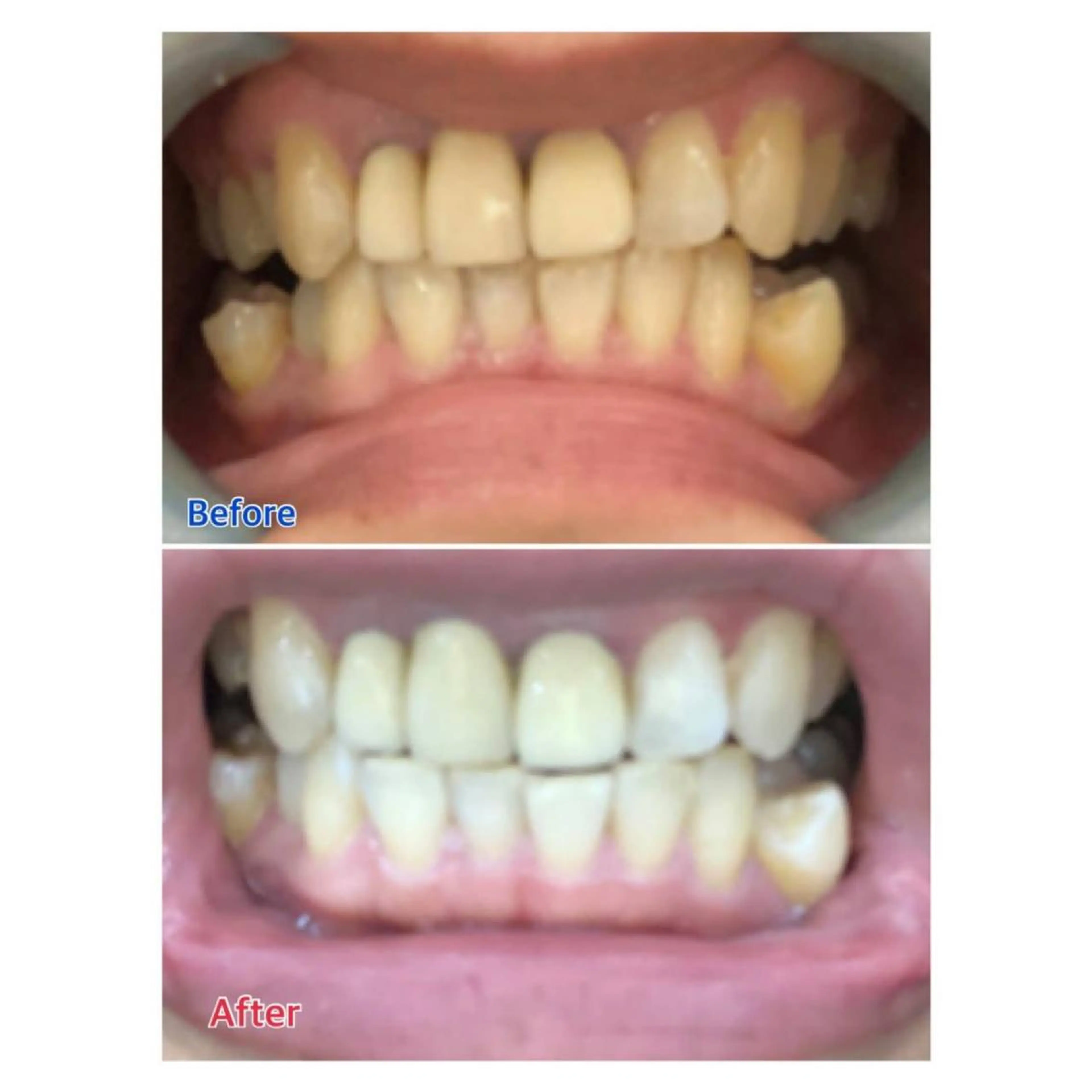 MBEAUTYSALON 千葉店・京成大久保所属・Melty 輝のその他イメージ