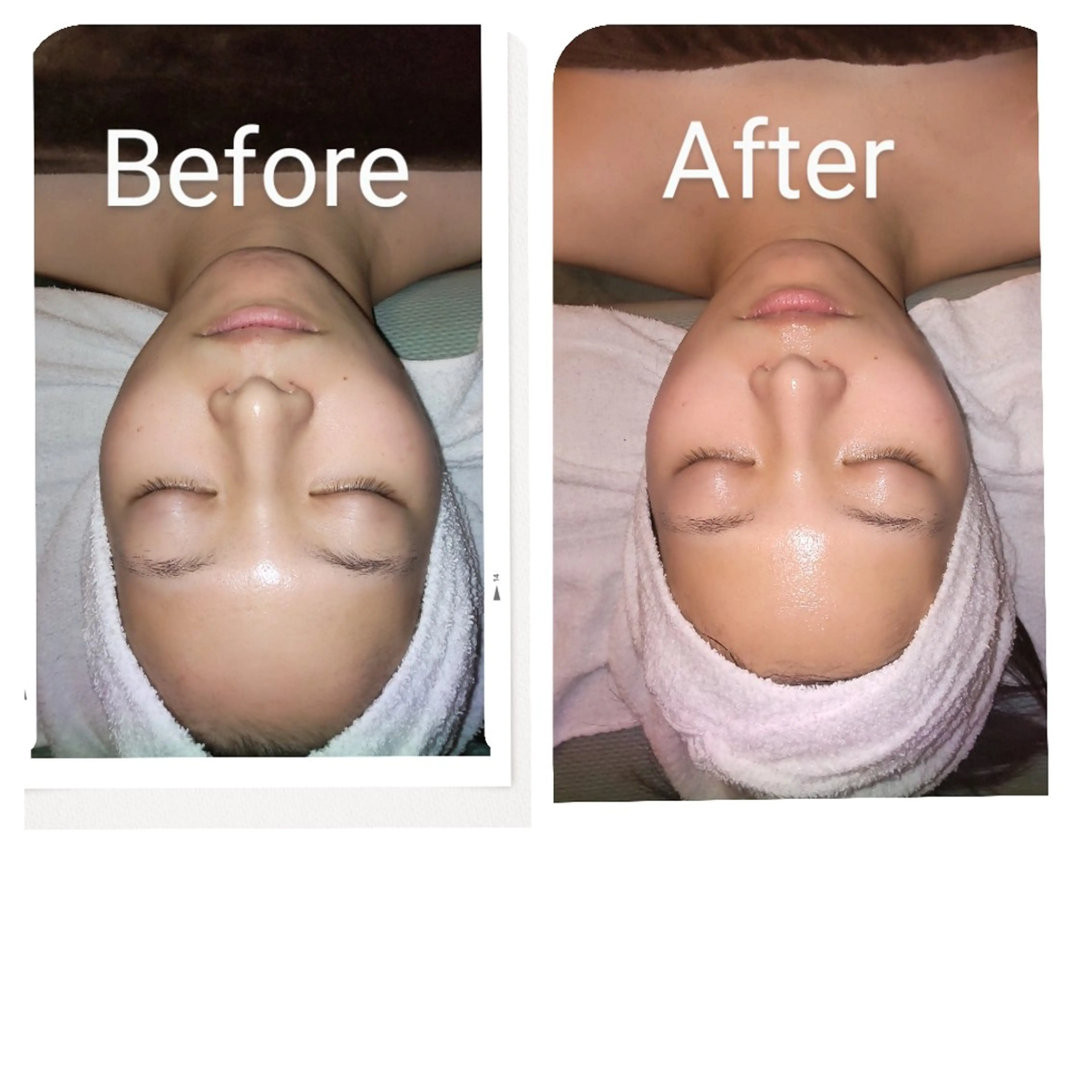 美肌SPAトリートメントの写真