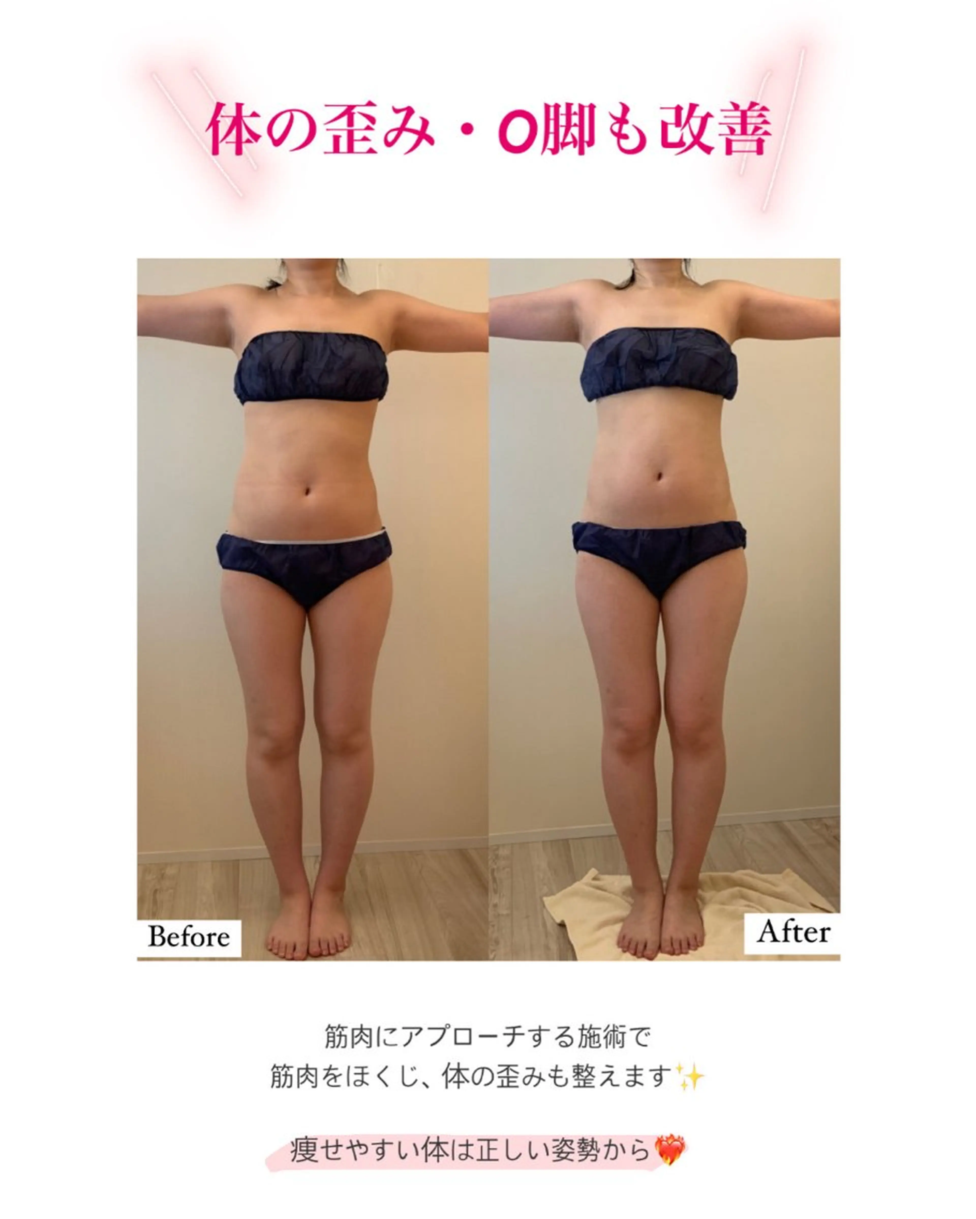 産後ダイエット−9㎏ Pourvous結衣のエステ・リラクイメージ