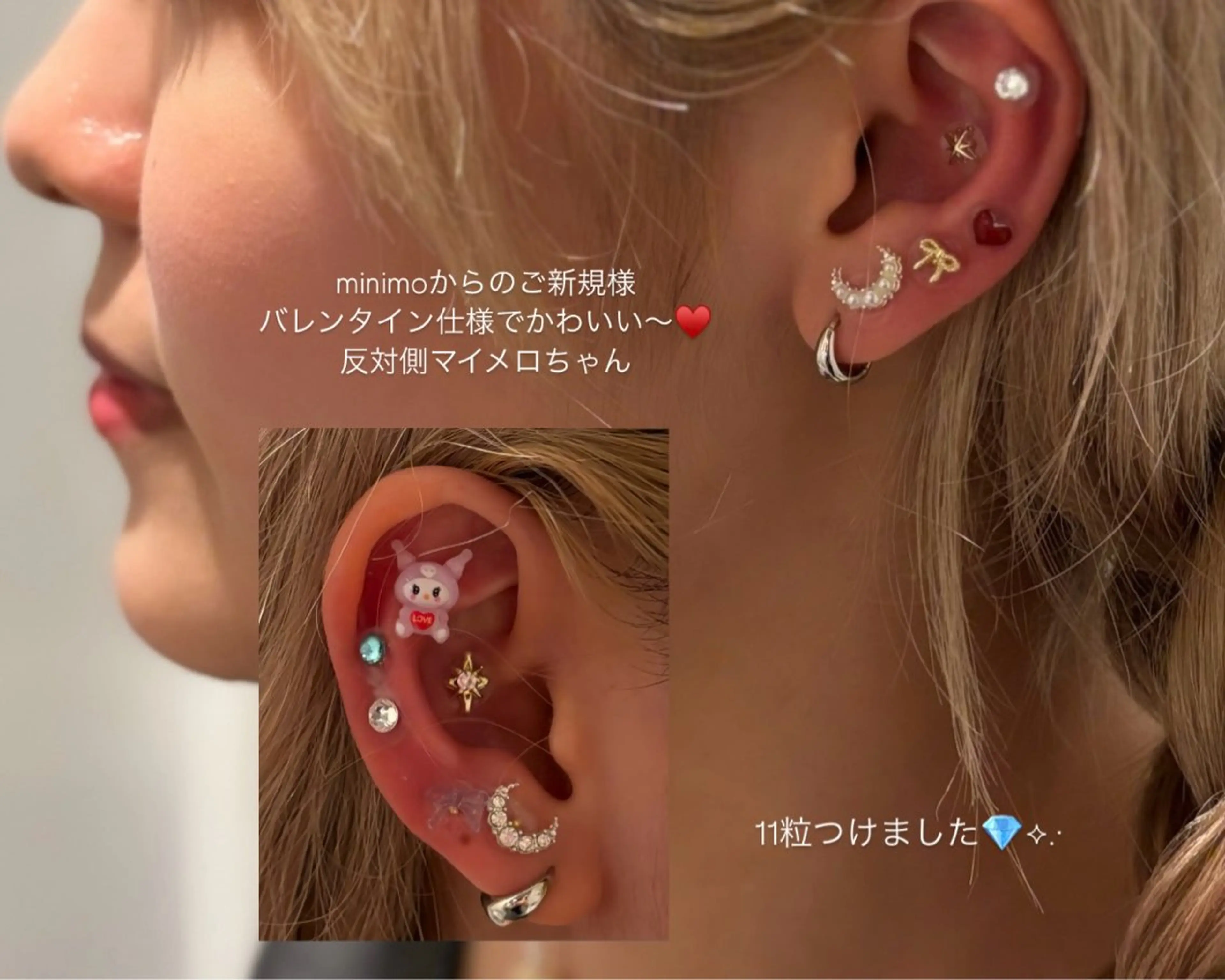 エステ リラク himee所属・艶肌ハーブピーリング /毛穴洗浄のエステ・リラクイメージ