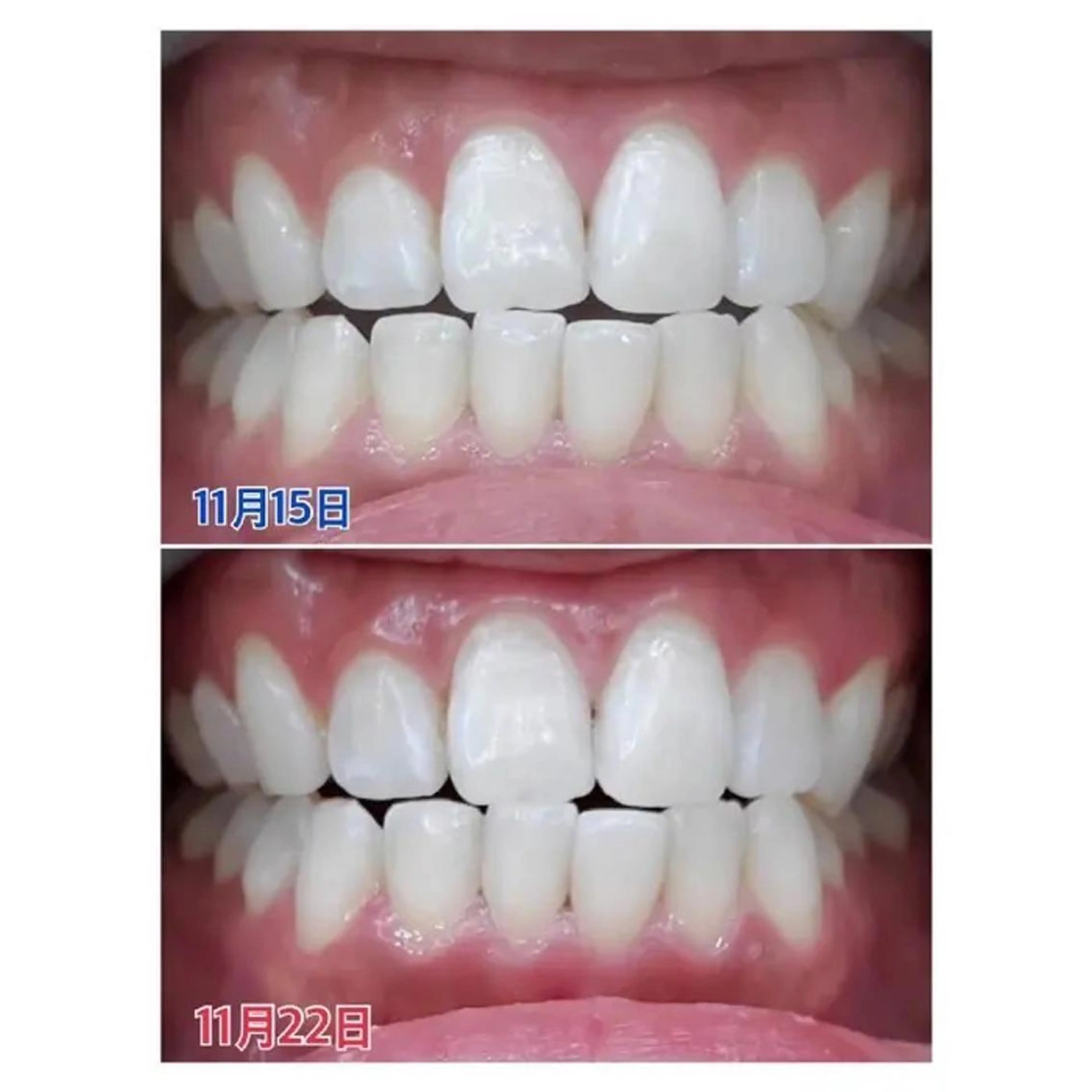 M渋谷店所属・M渋谷 ホワイトニングのエステ・リラクイメージ