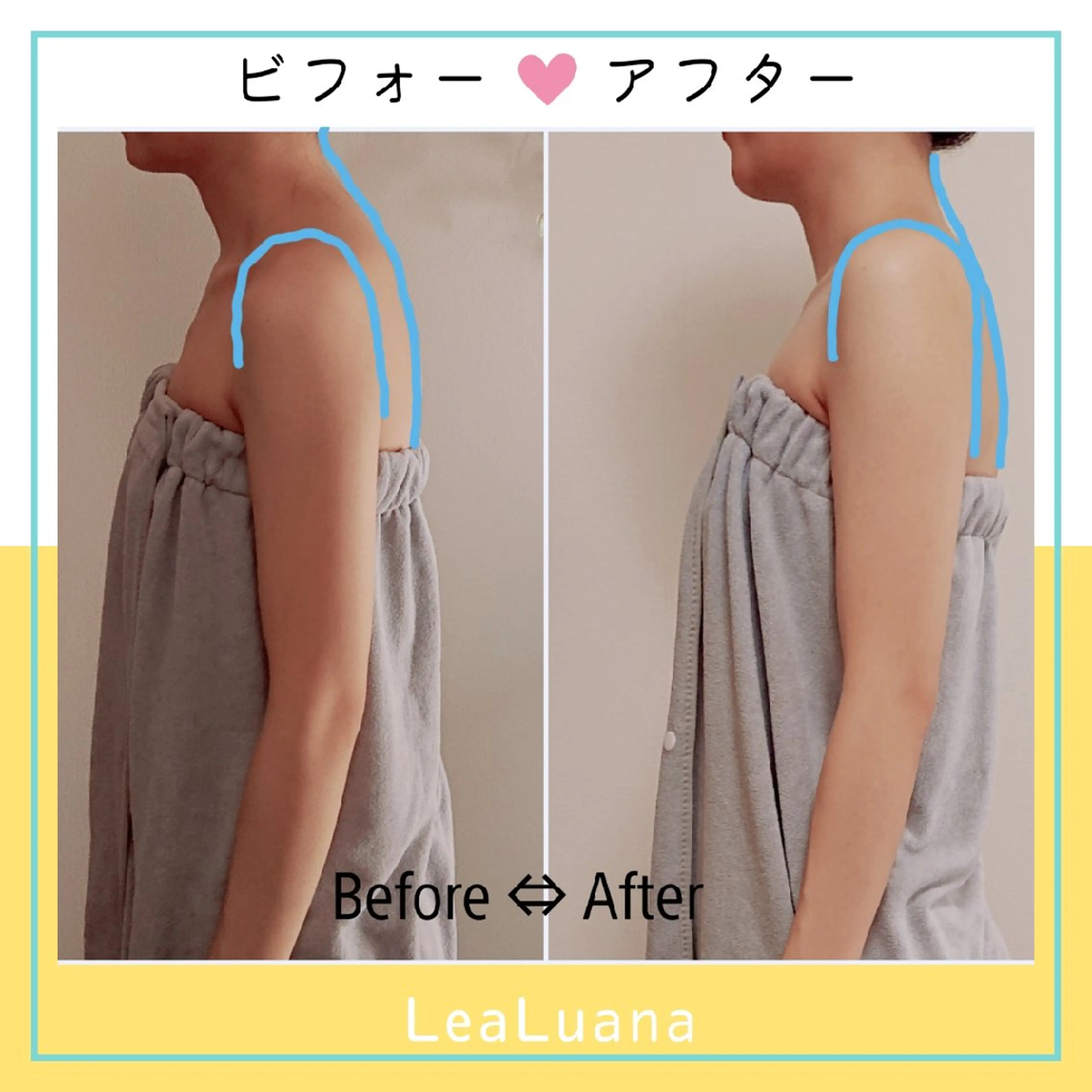 ③【👑人気No.1】【初回🌟半額】痩せ見え!!美姿勢ﾒｲｷﾝｸﾞ60分/理想の上半身へ✨猫背/反り腰/巻き肩/肩ｺﾘの写真