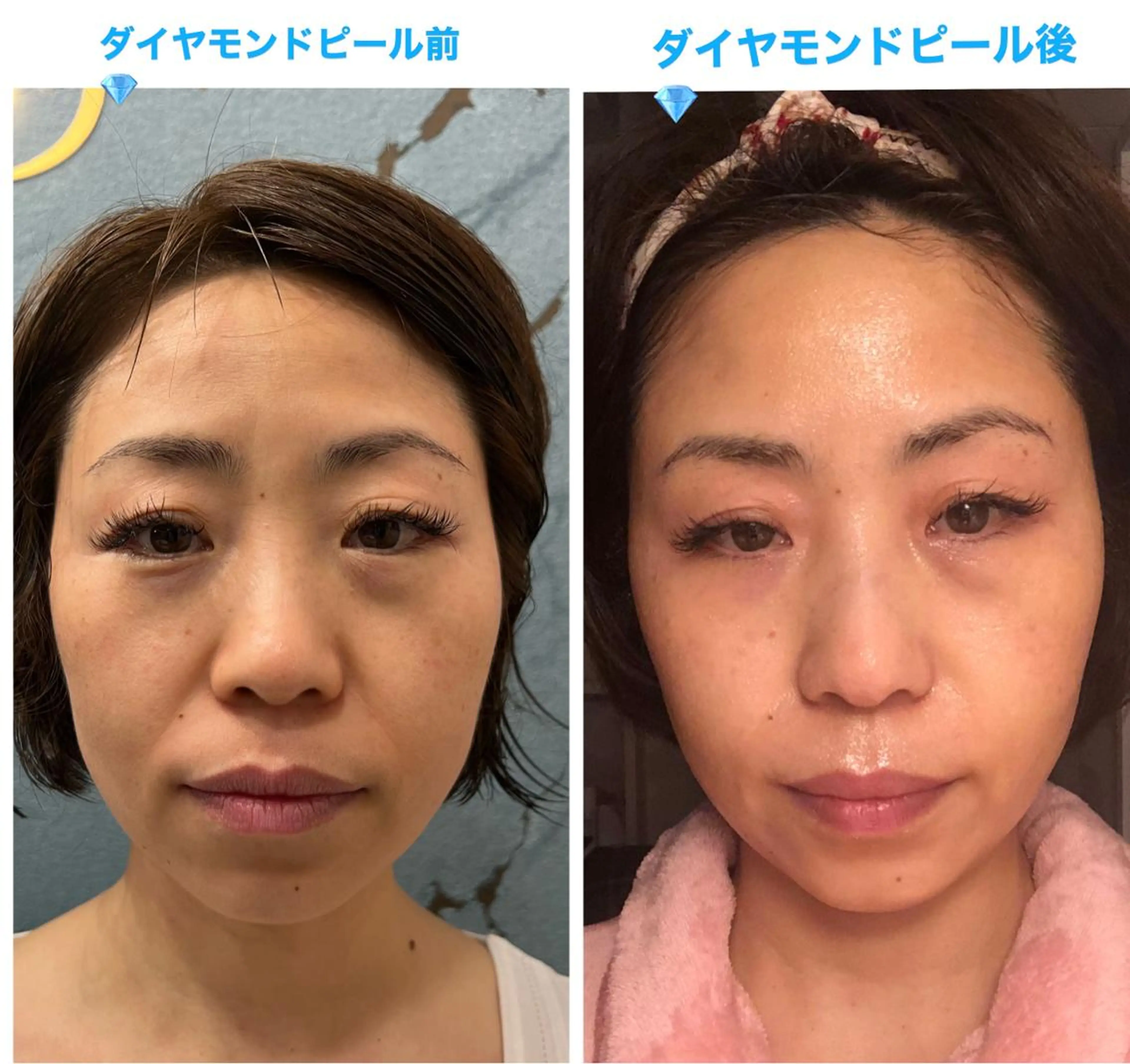 リラクゼーション ルナのエステ・リラクイメージ