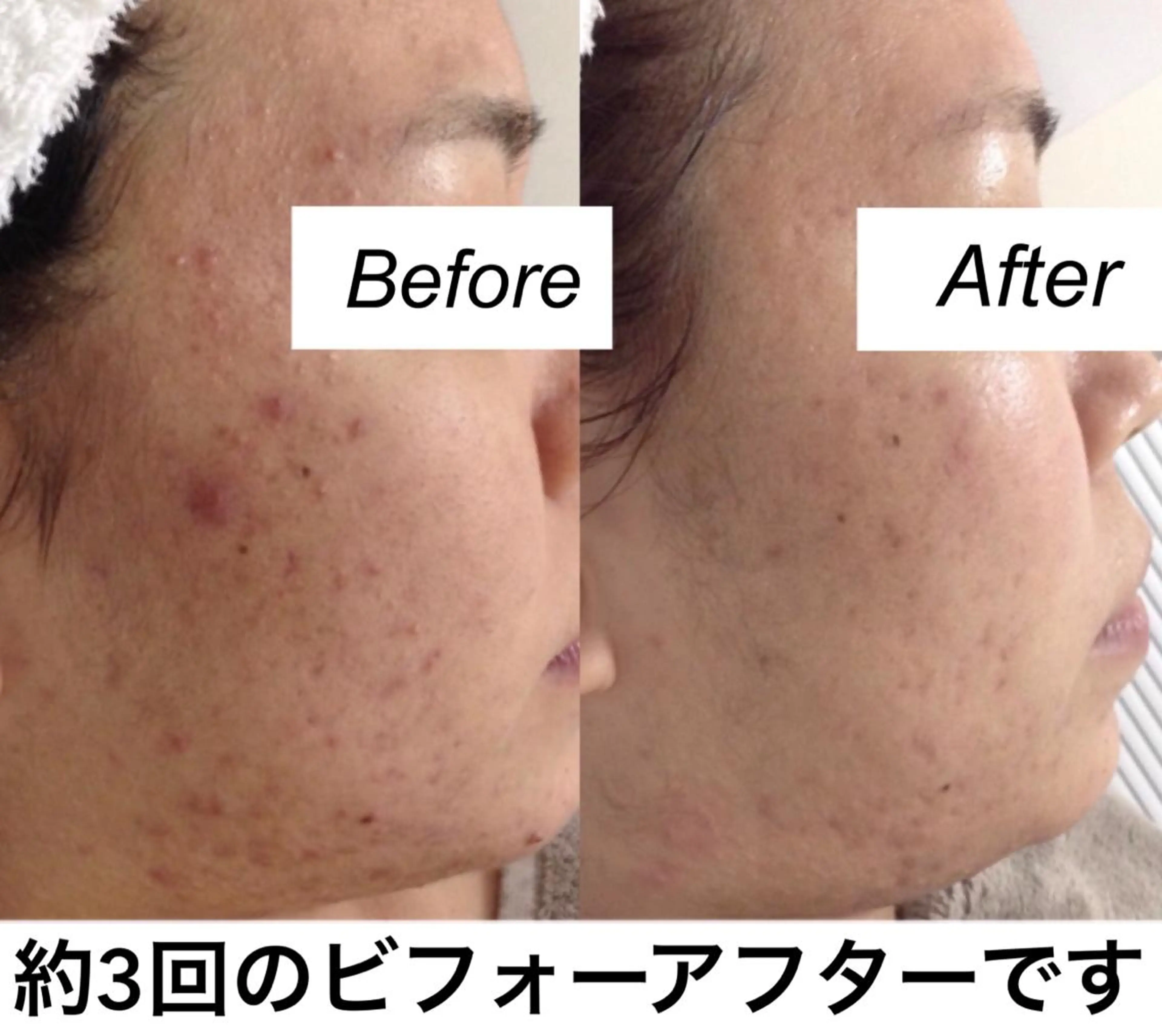 ネイル マツエク・マツパ エステ リラク 都度払い肌質改善 &脱毛Blancheのエステ・リラクイメージ