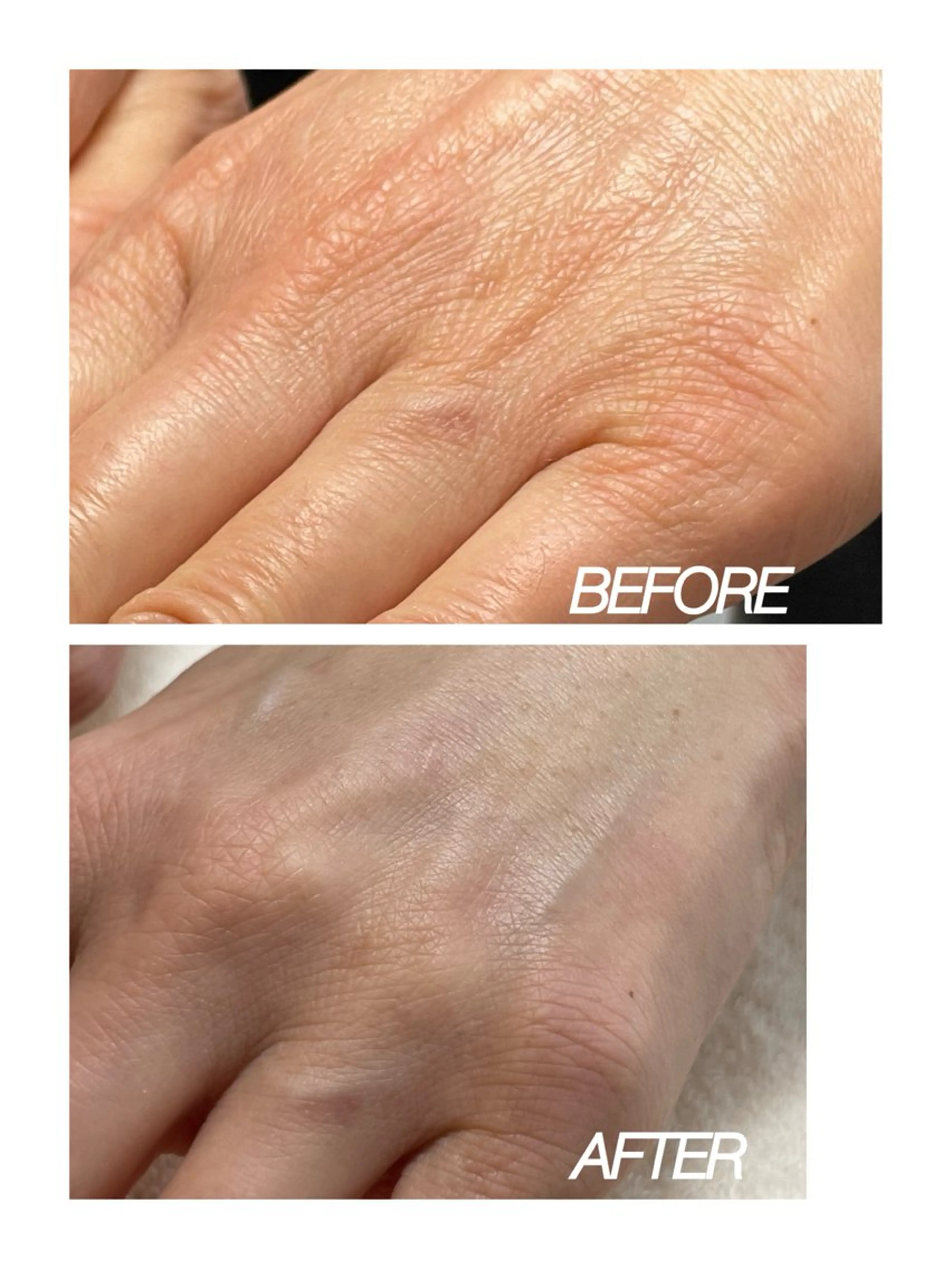 ネイル Chong Sarangのネイルデザイン