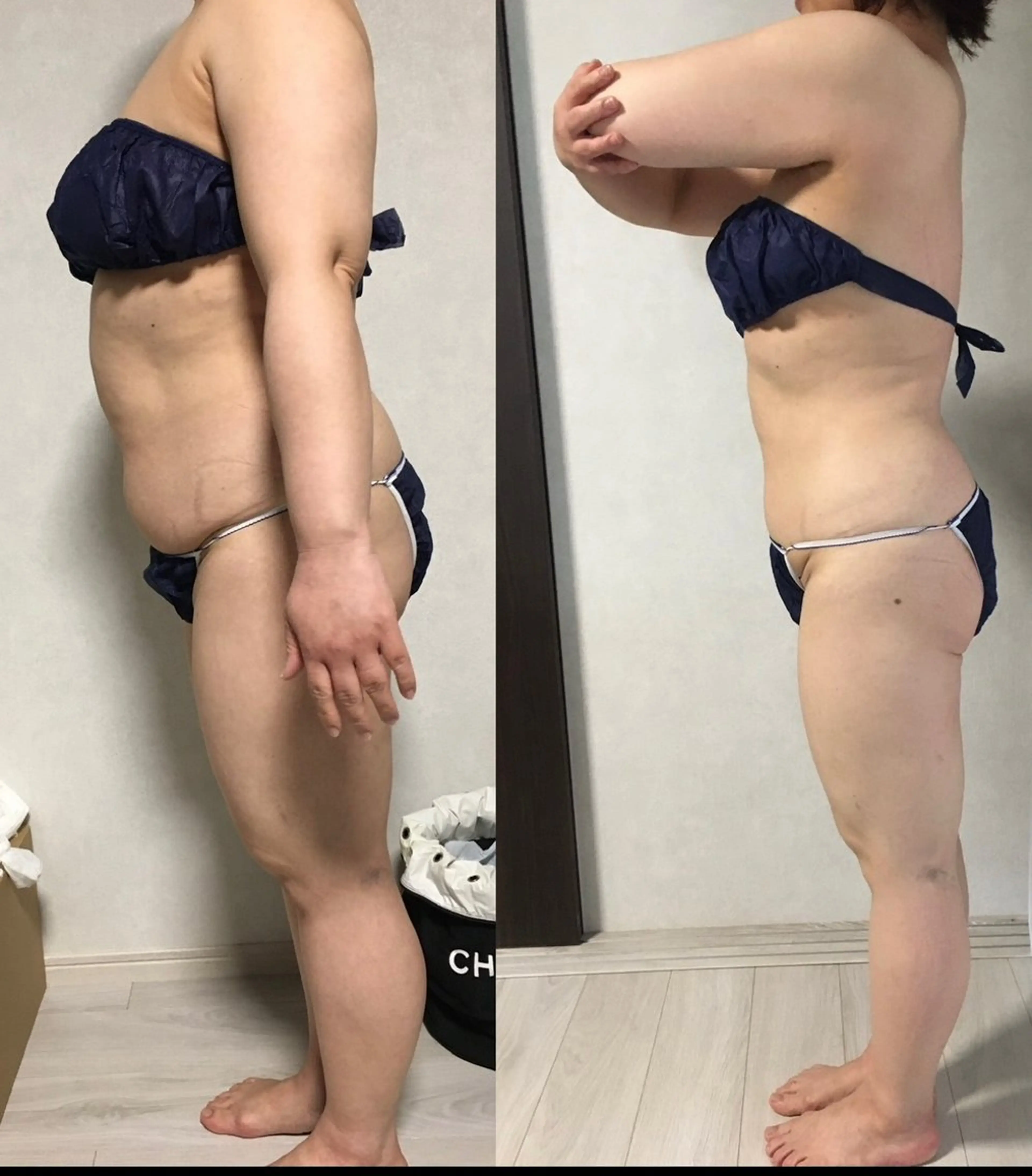 salon de blue rose所属・ハイパーナイフ専門 熊田陽子のエステ・リラクイメージ