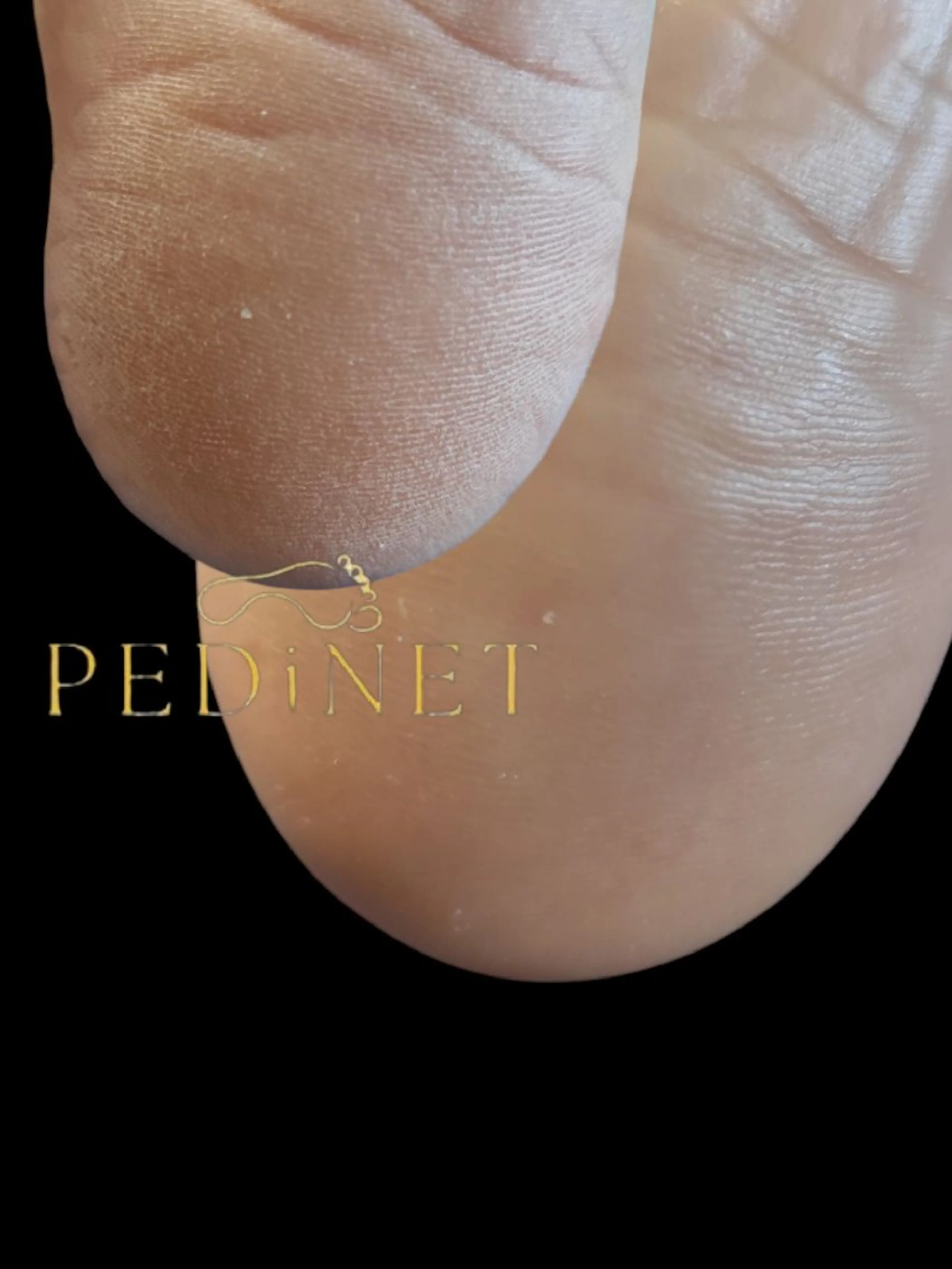 美肌脱毛サロン つるりと御殿場店所属・美肌脱毛サロン つるりとのその他イメージ