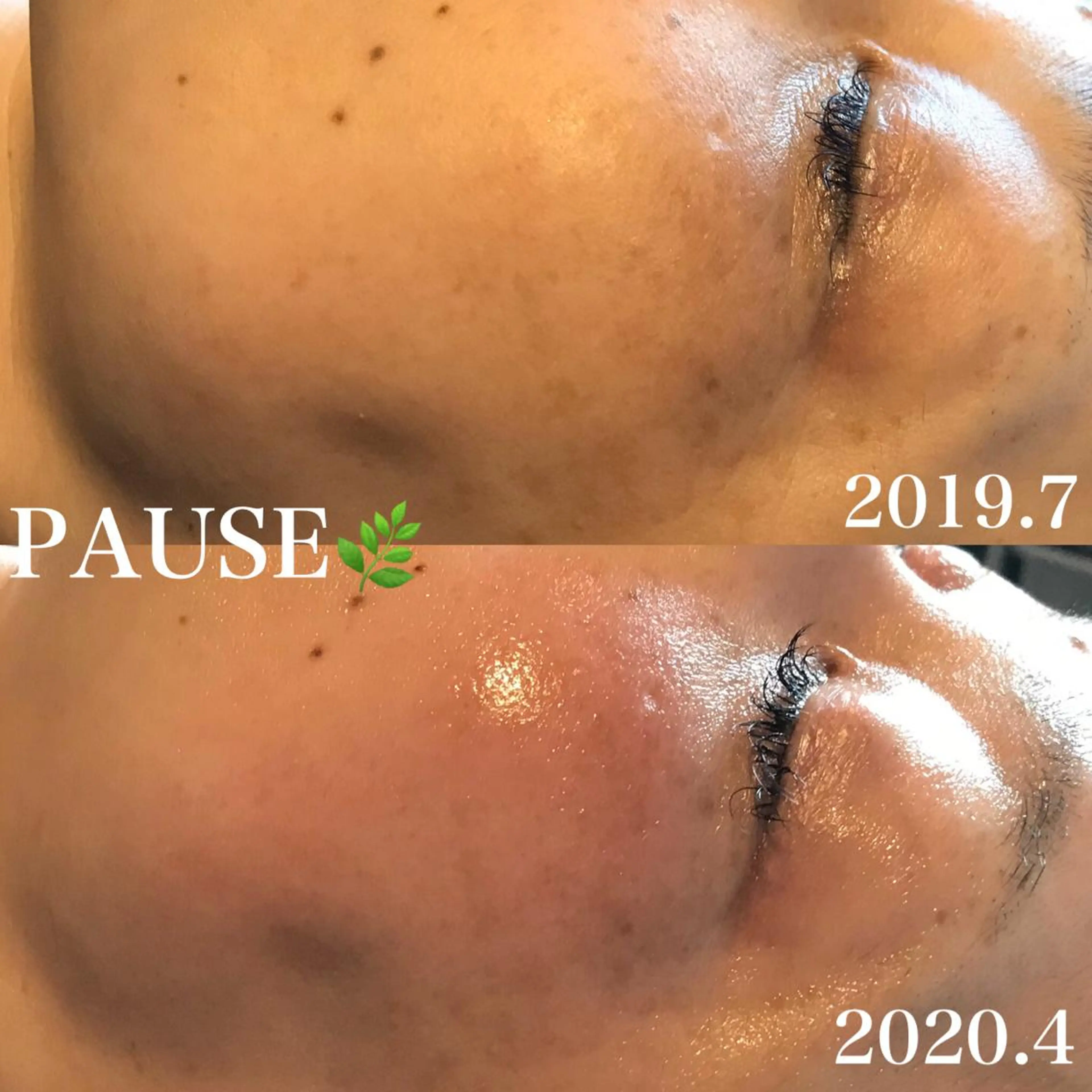 エステ 浜野 恵美のエステ・リラクイメージ