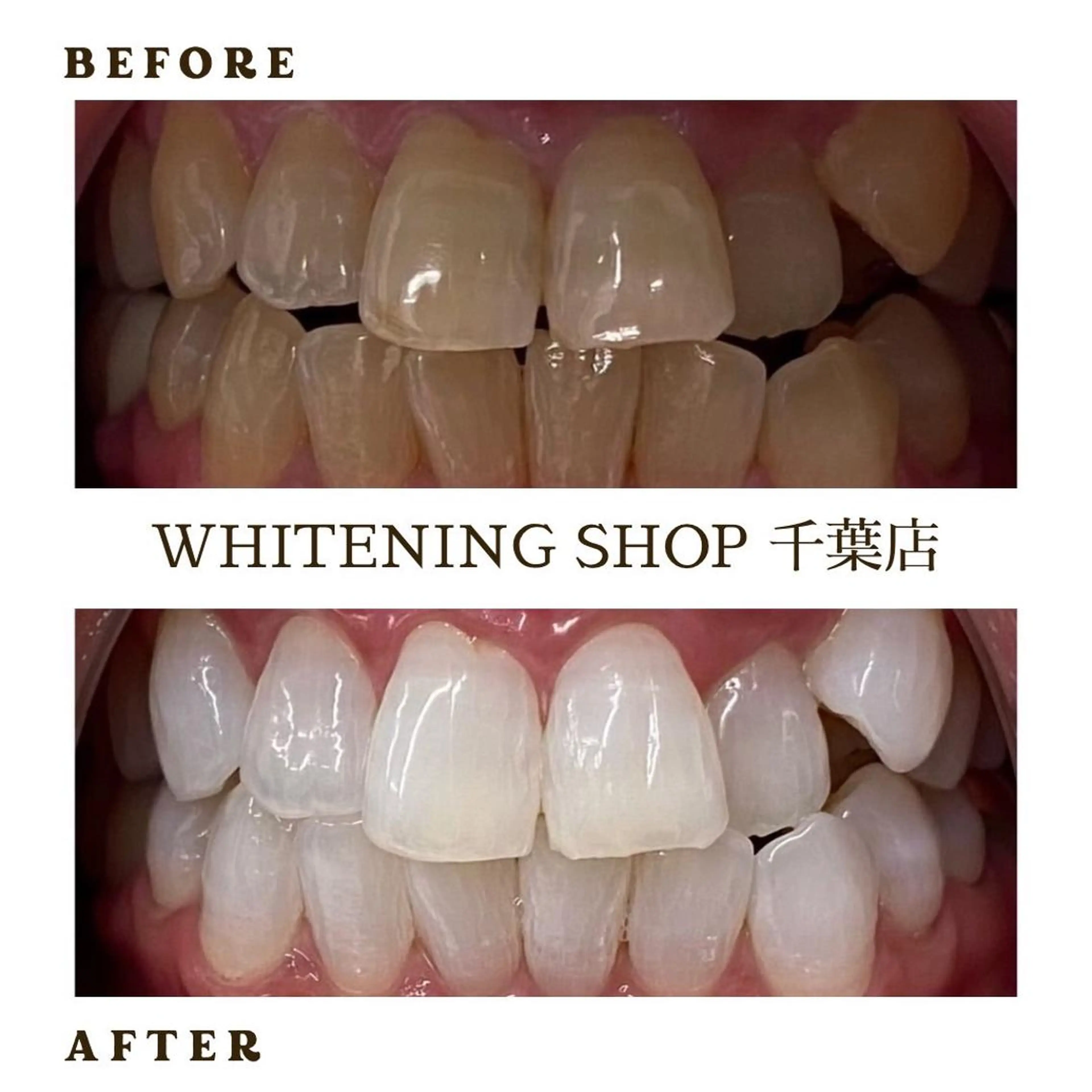 メンズ その他 ホワイトニング ショップ千葉店のその他イメージ