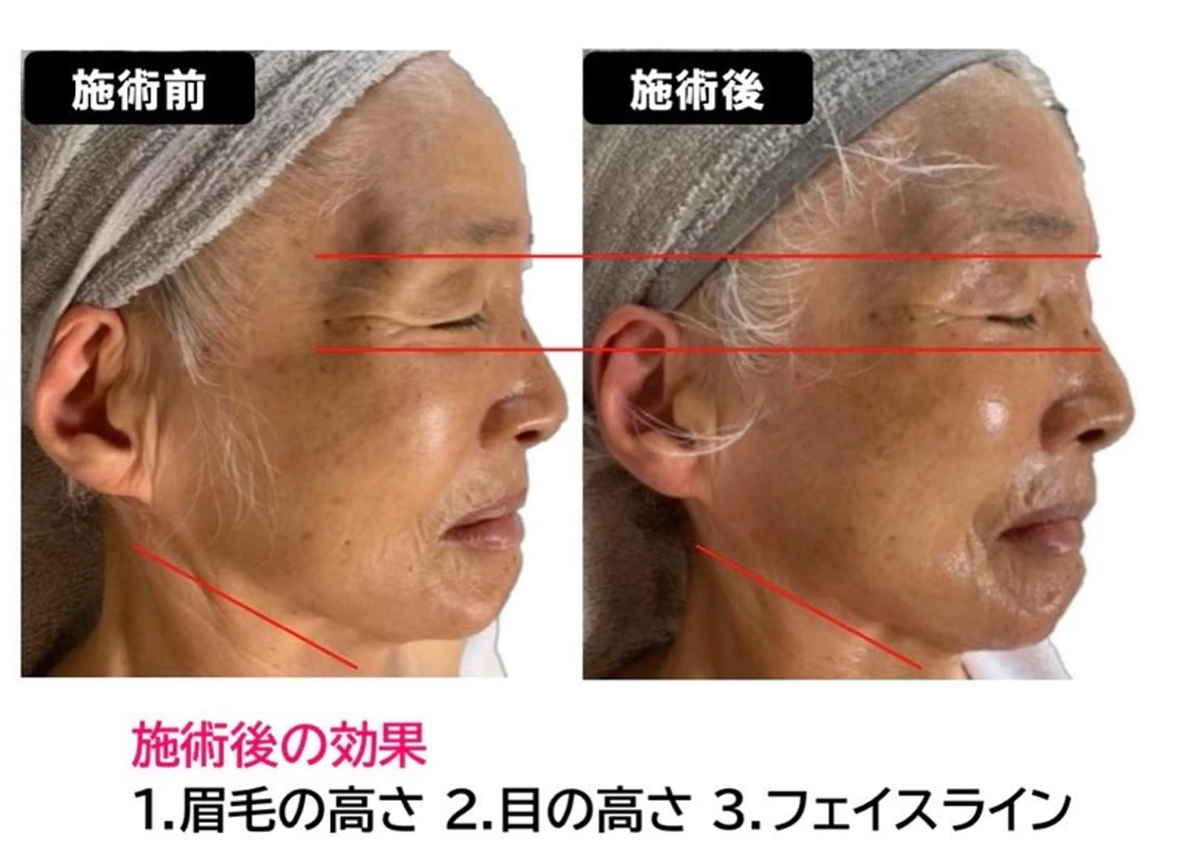 ヴィーナス ビューティーのエステ・リラクイメージ