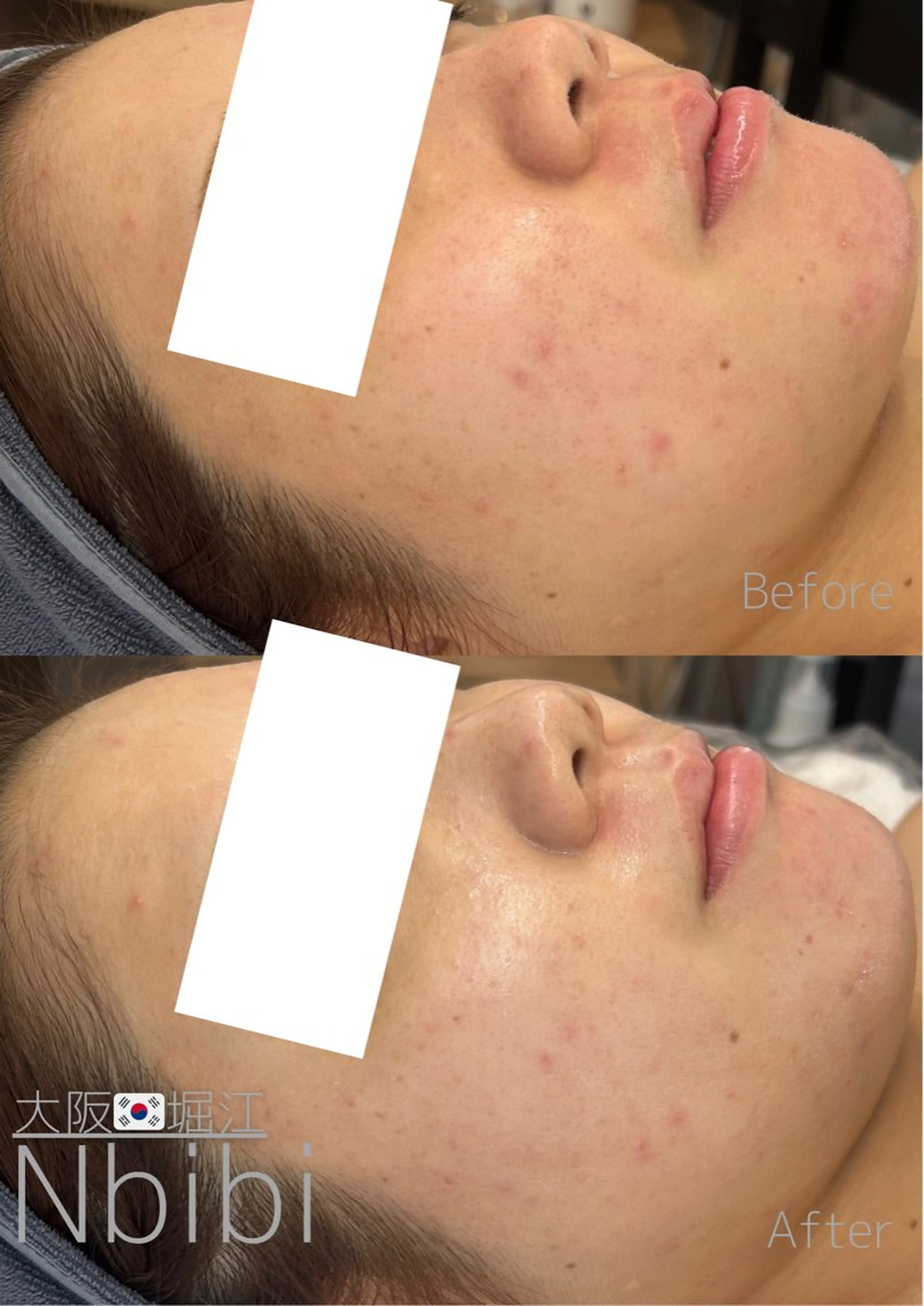 エステ 韓国🇰🇷価格 サロン_Nbibiのエステ・リラクイメージ