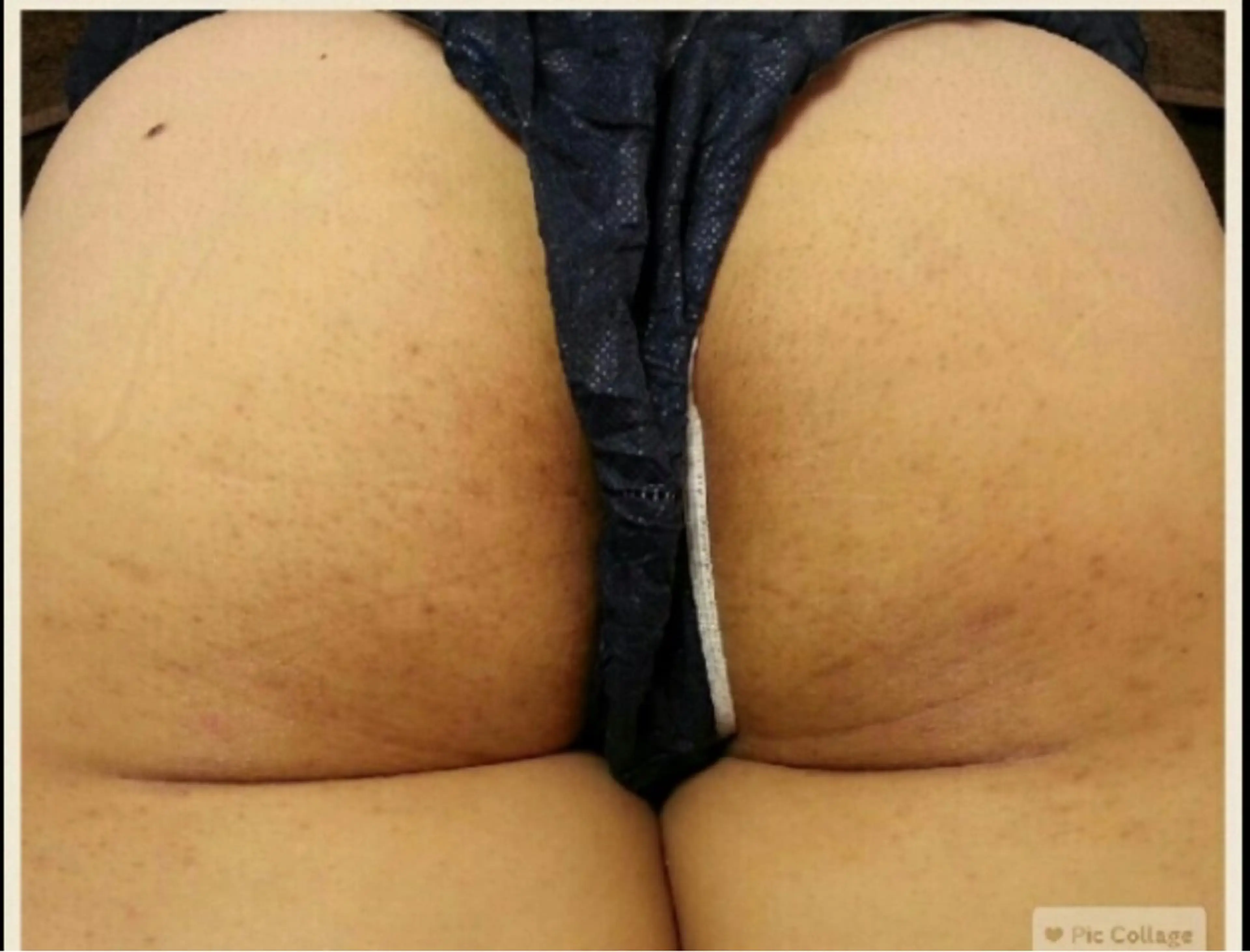 ピーリングサロン シャンテールのエステ・リラクイメージ