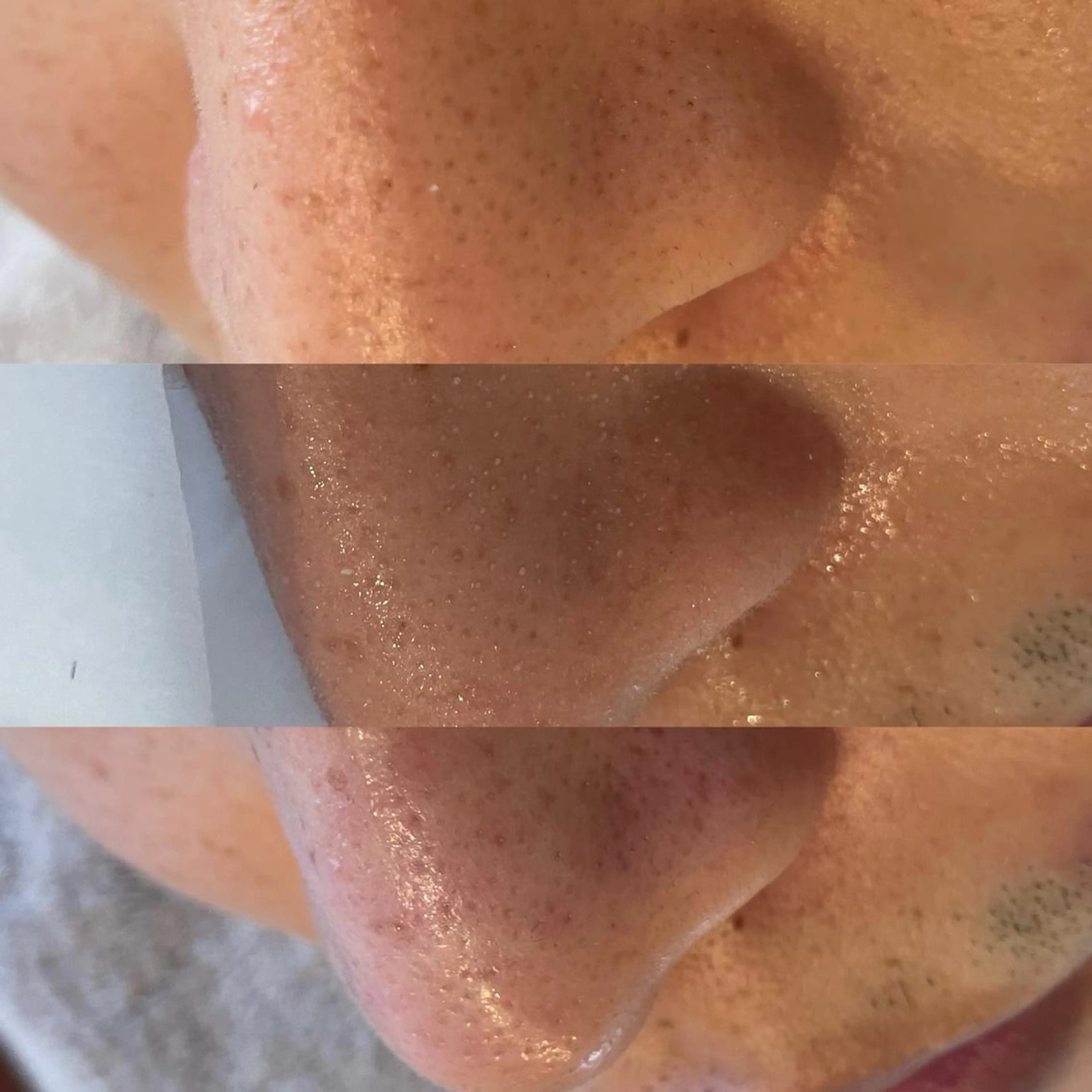 メンズ アイブロウ Amm所属・🏆艶肌ワックス🏆 ララピール✨Ammのエステ・リラクイメージ