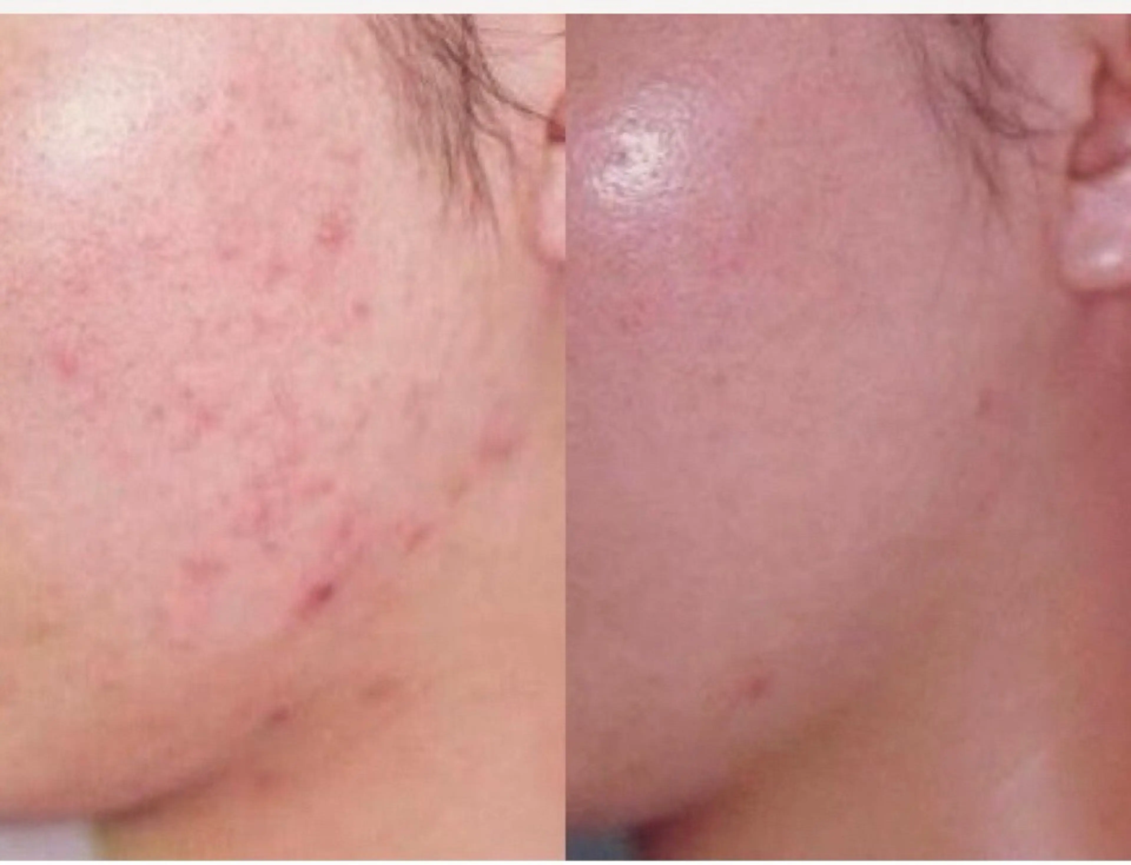 エステ 最速小顔・肌質管理 espoirマキのエステ・リラクイメージ