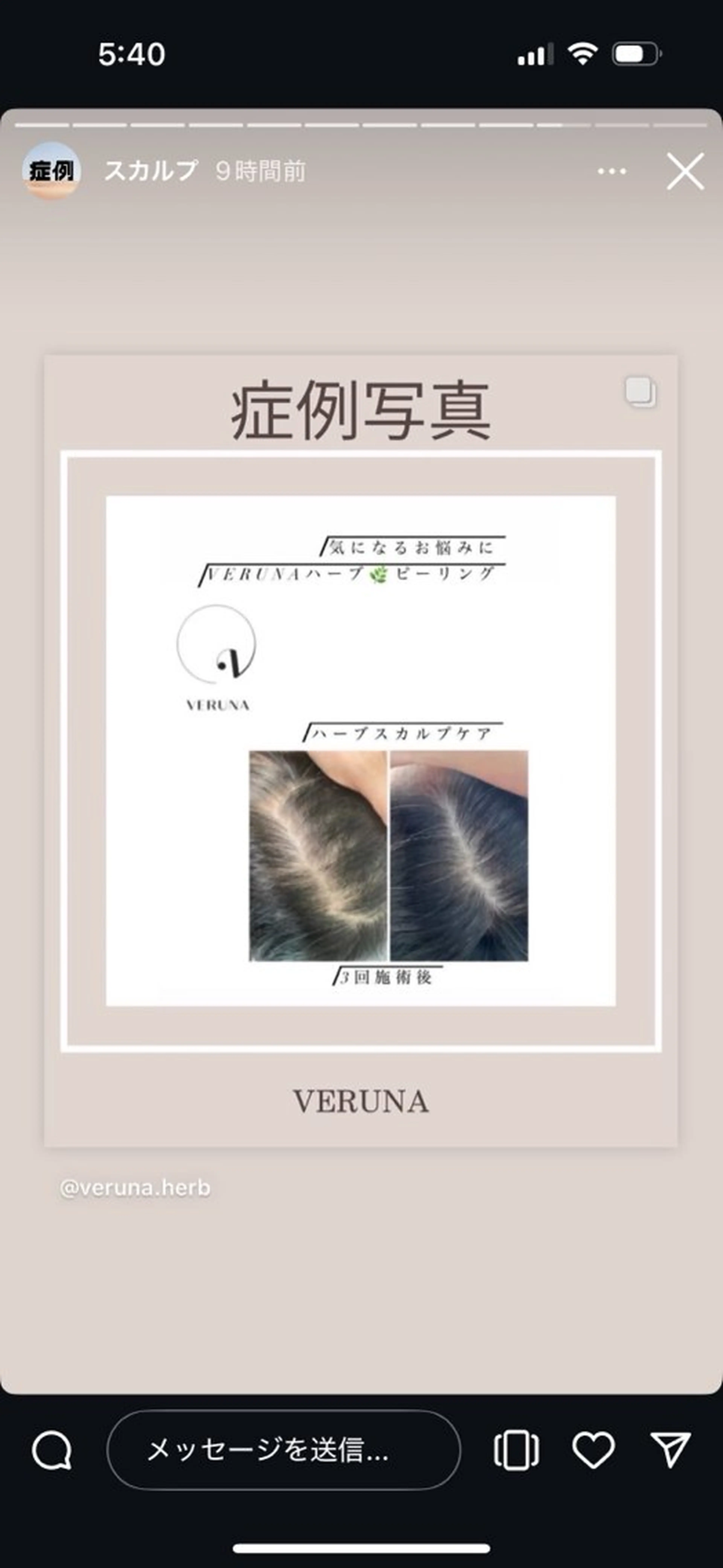 Grandir所属・ハーブピーリング専門 グランディール　武内のエステ・リラクイメージ