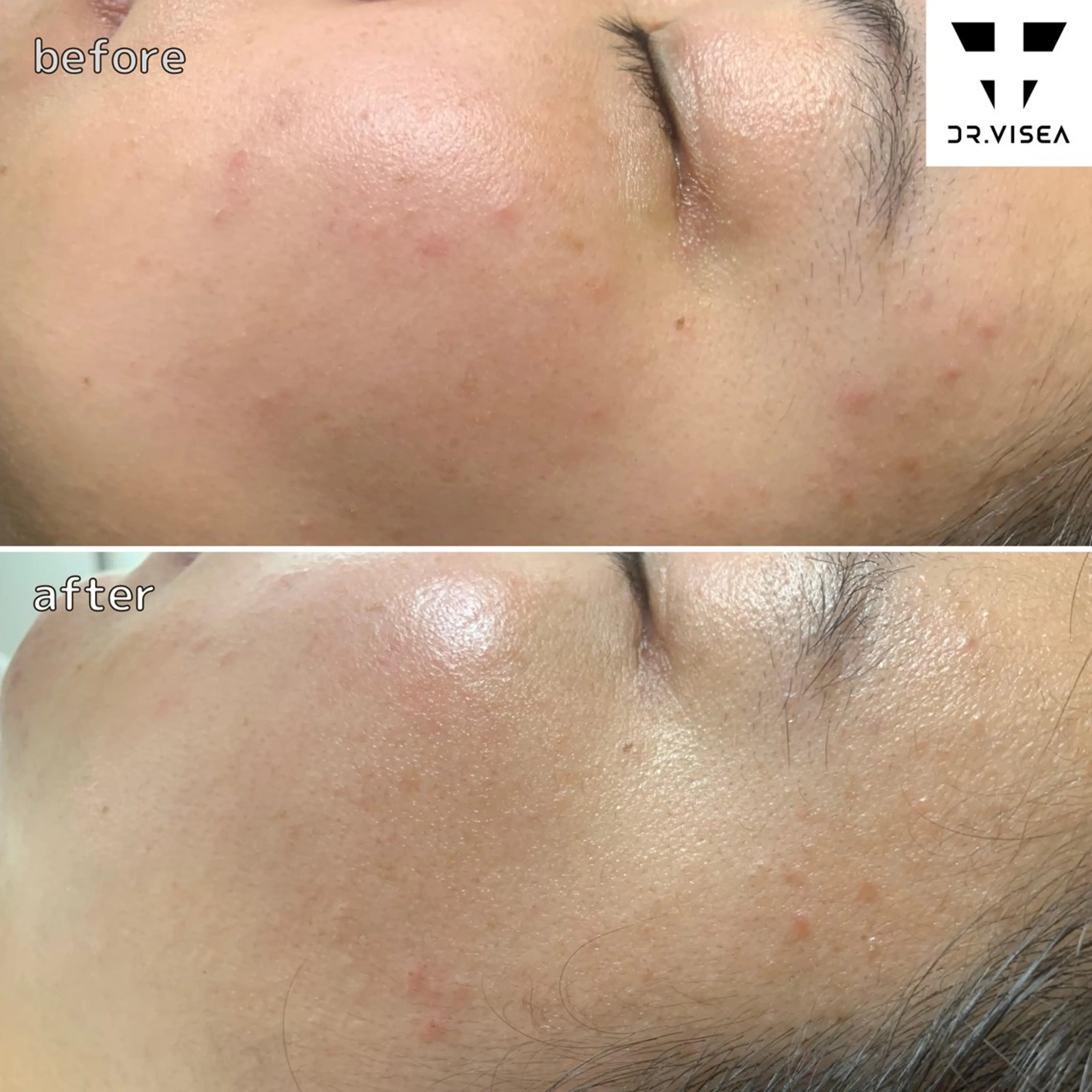 エステ “川越で選ばれる” 🫧ニナル🫧のエステ・リラクイメージ