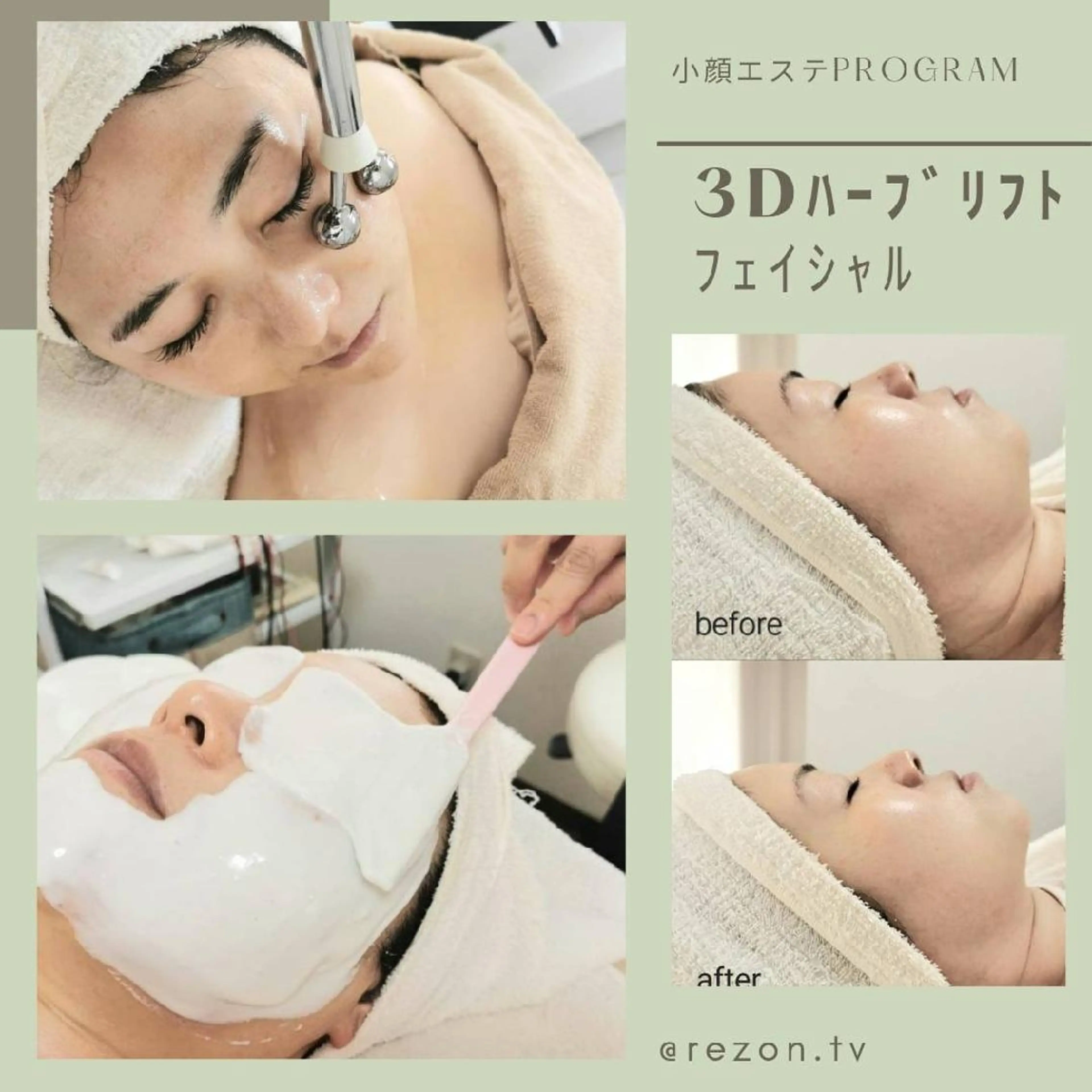 《エイジングケアにもおすすめ！小顔ケアでリフトアップ☆たるみ改善！》速攻小顔エステ✨　[大阪城北詰駅/京橋駅]の写真