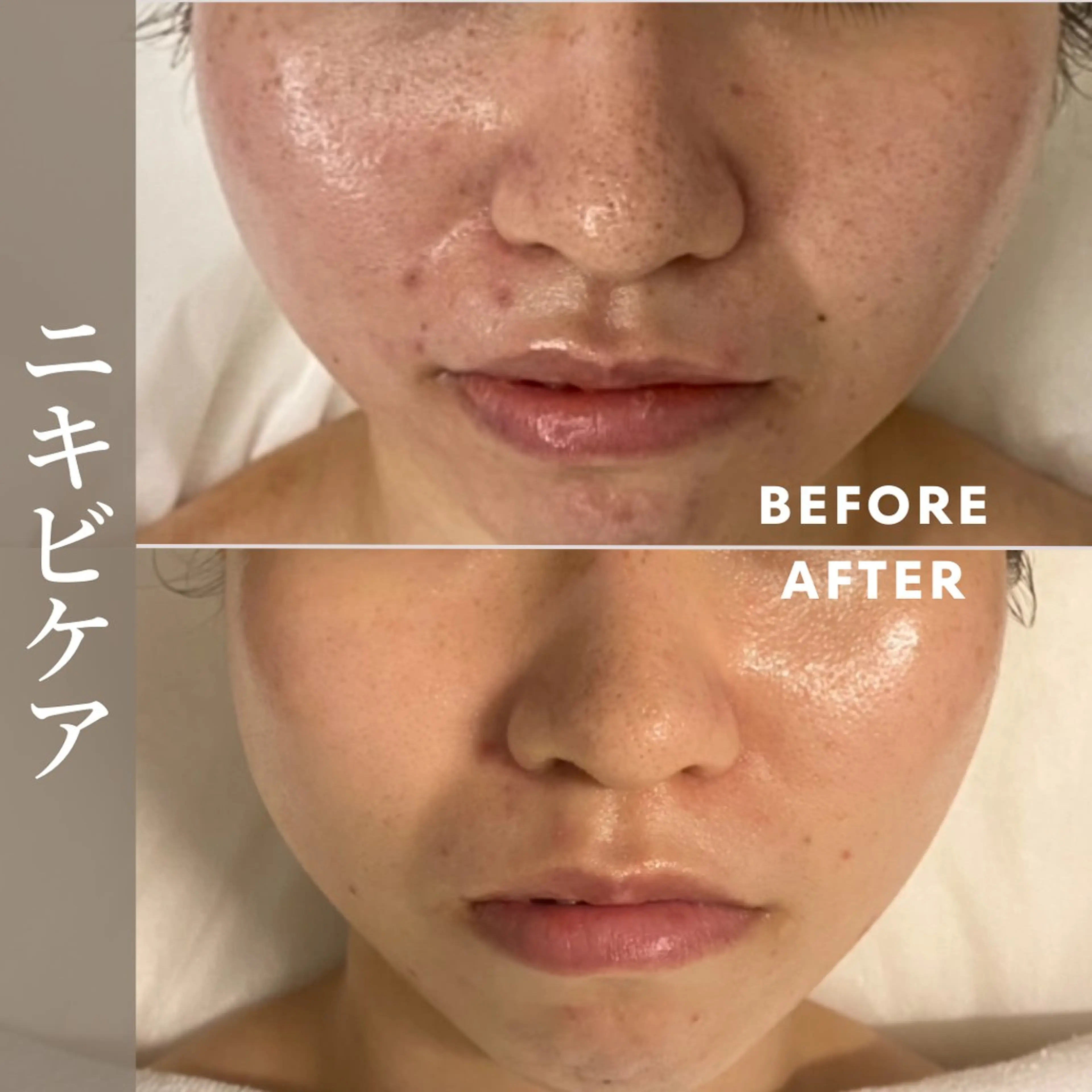 肌育成サロン ♡ RISAのエステ・リラクイメージ