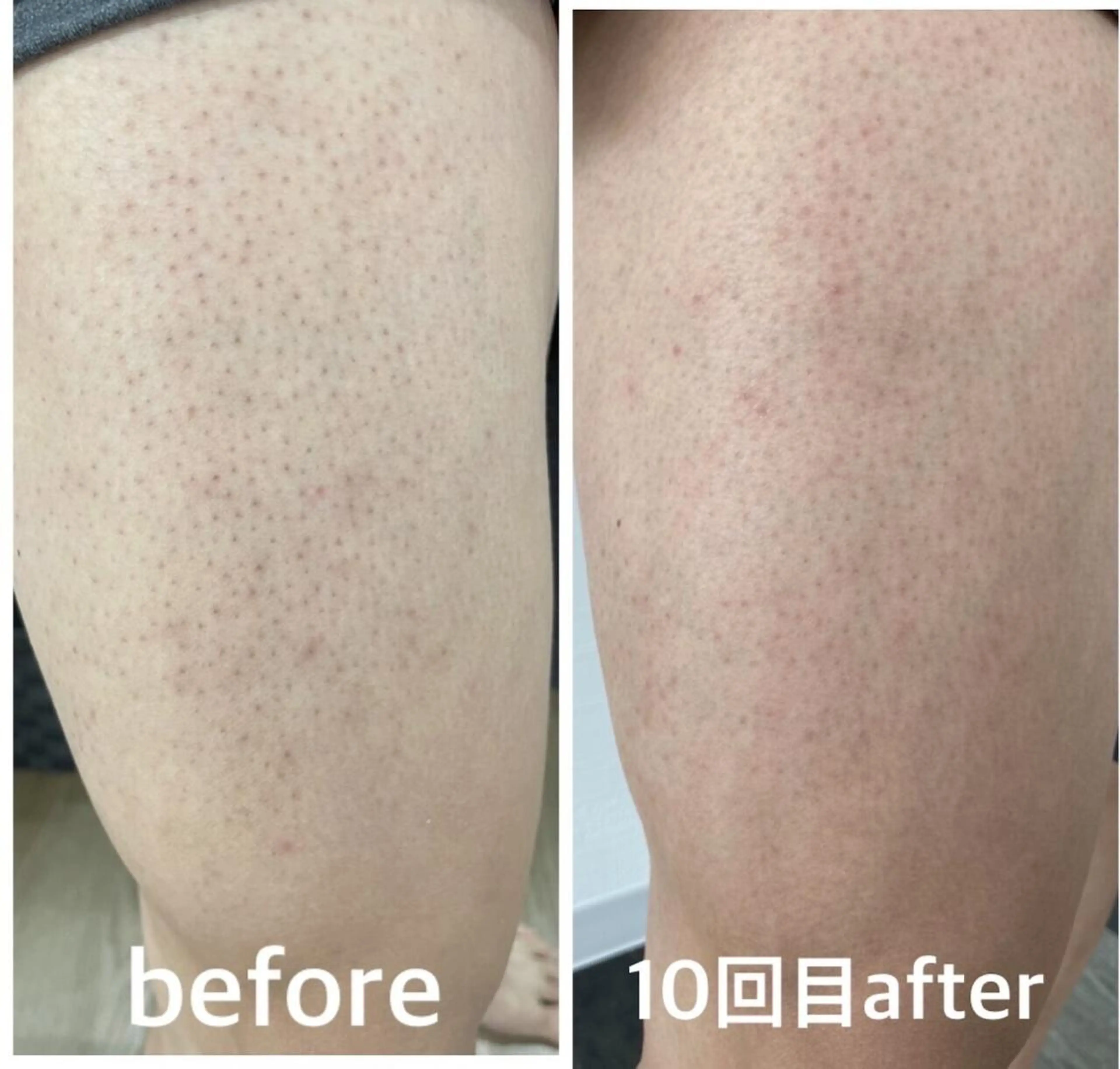 SELFMADE 石巻店のエステ・リラクイメージ