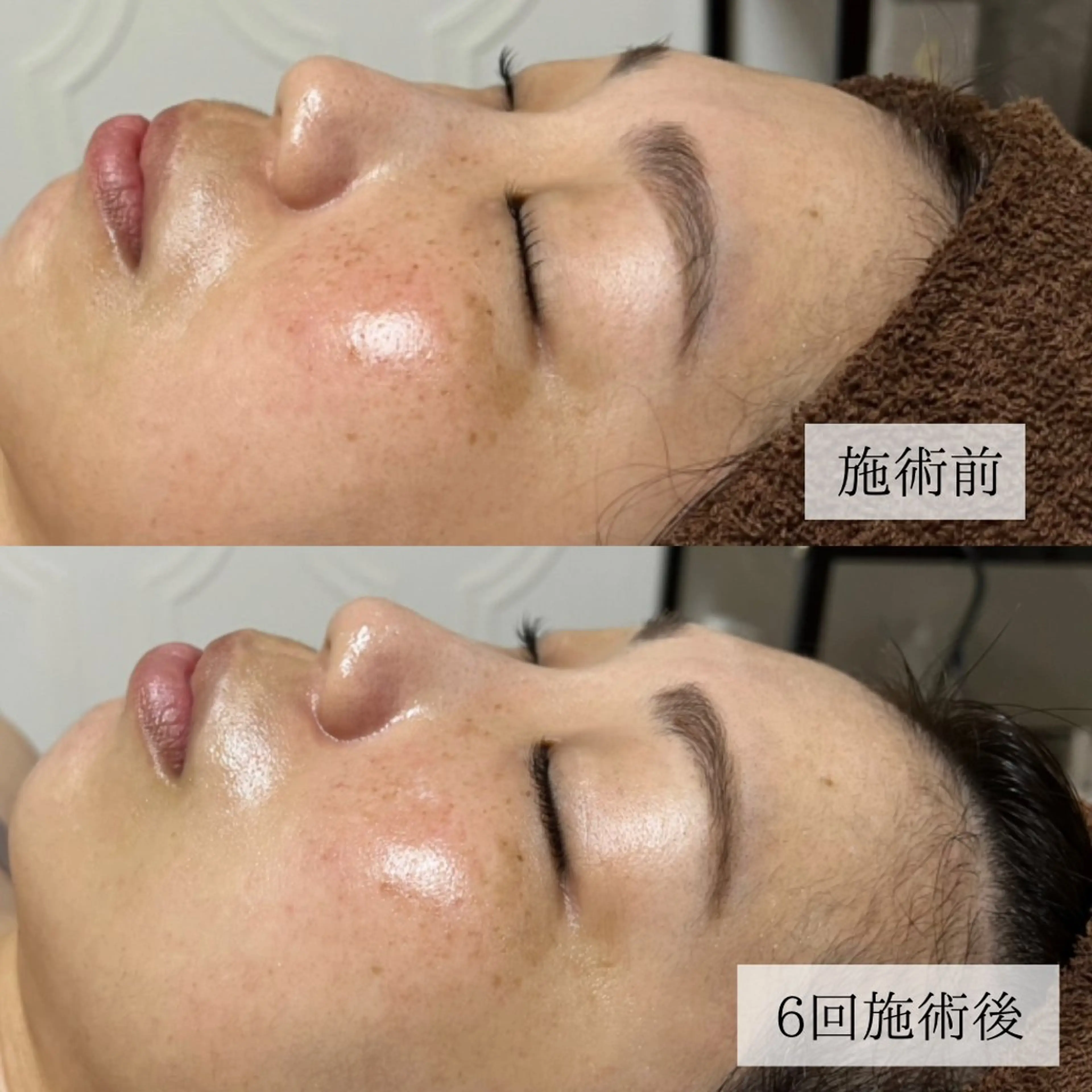 宮本 瞳のエステ・リラクイメージ