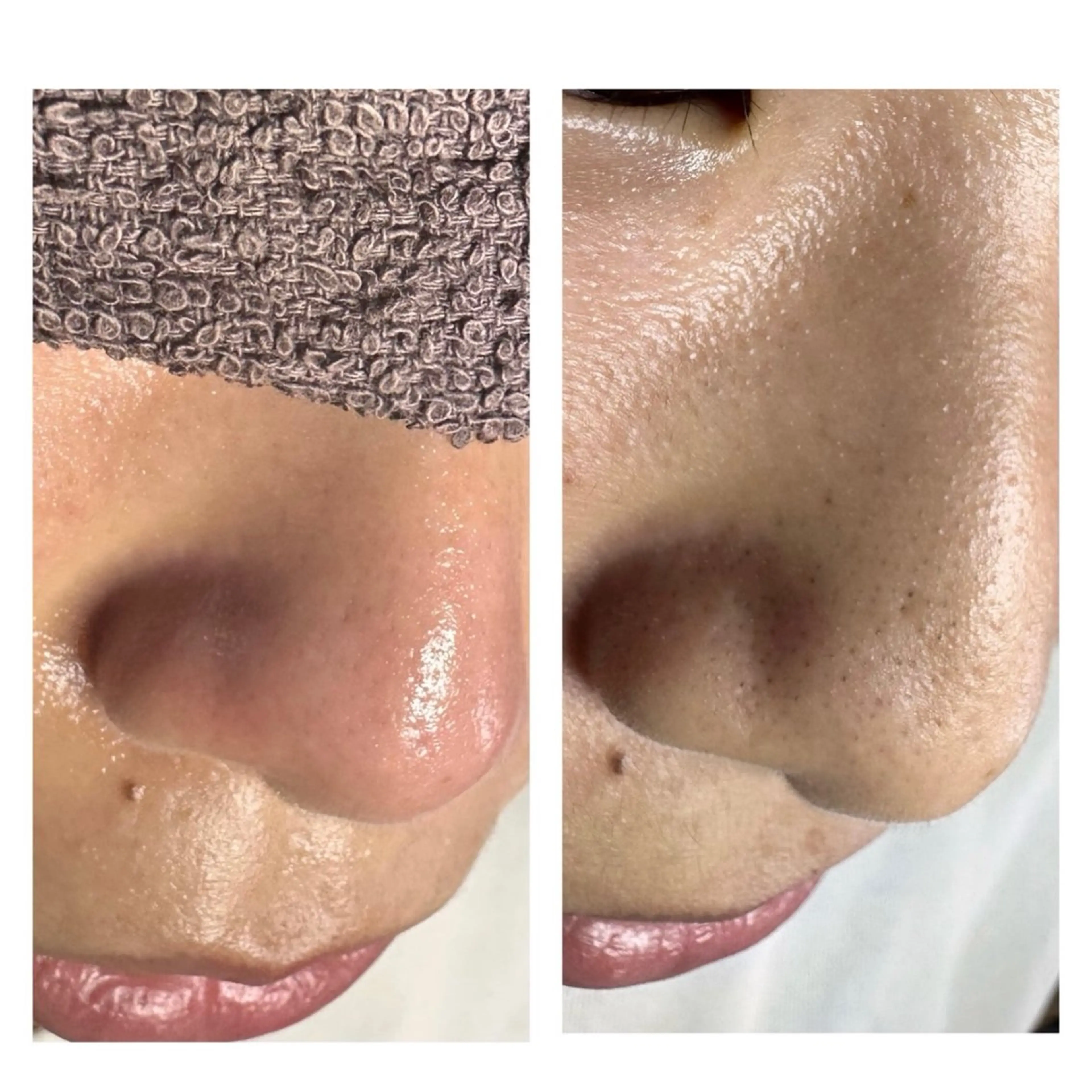 エステ 和田 澪のエステ・リラクイメージ