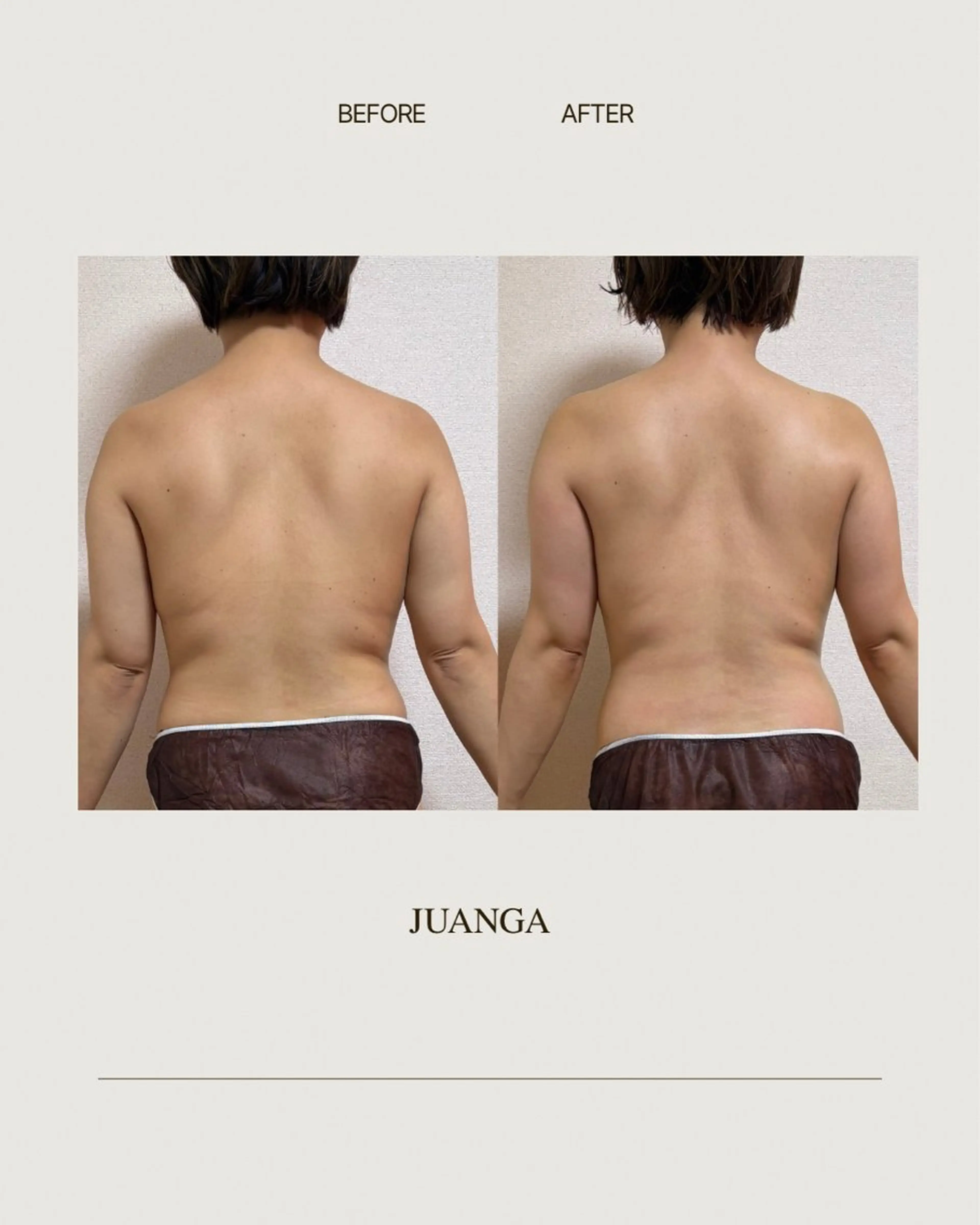 ジュアンガ所属・JUANGA Aiのエステ・リラクイメージ