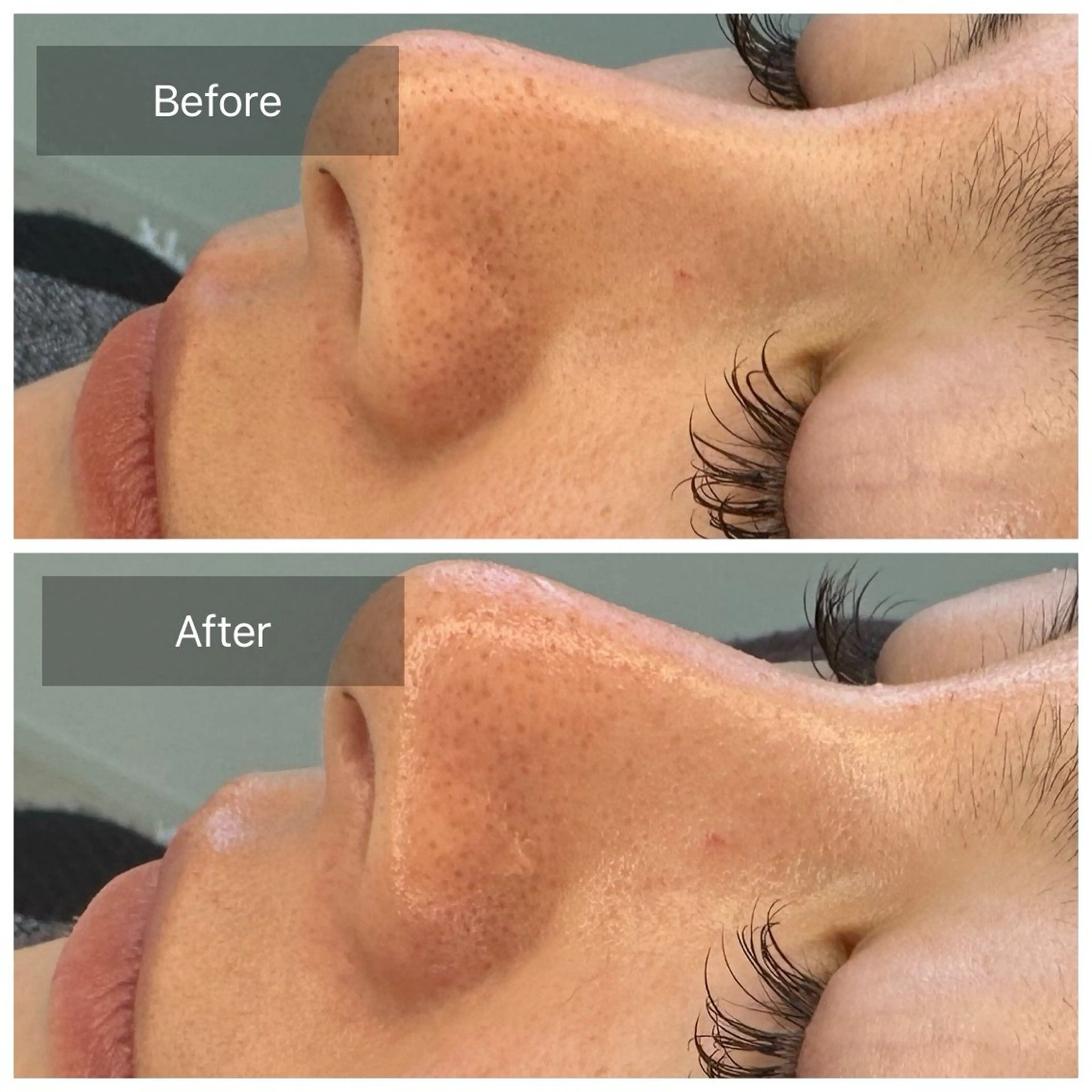 脱毛 トータルしみケア専門 NICA(ニカ)のエステ・リラクイメージ