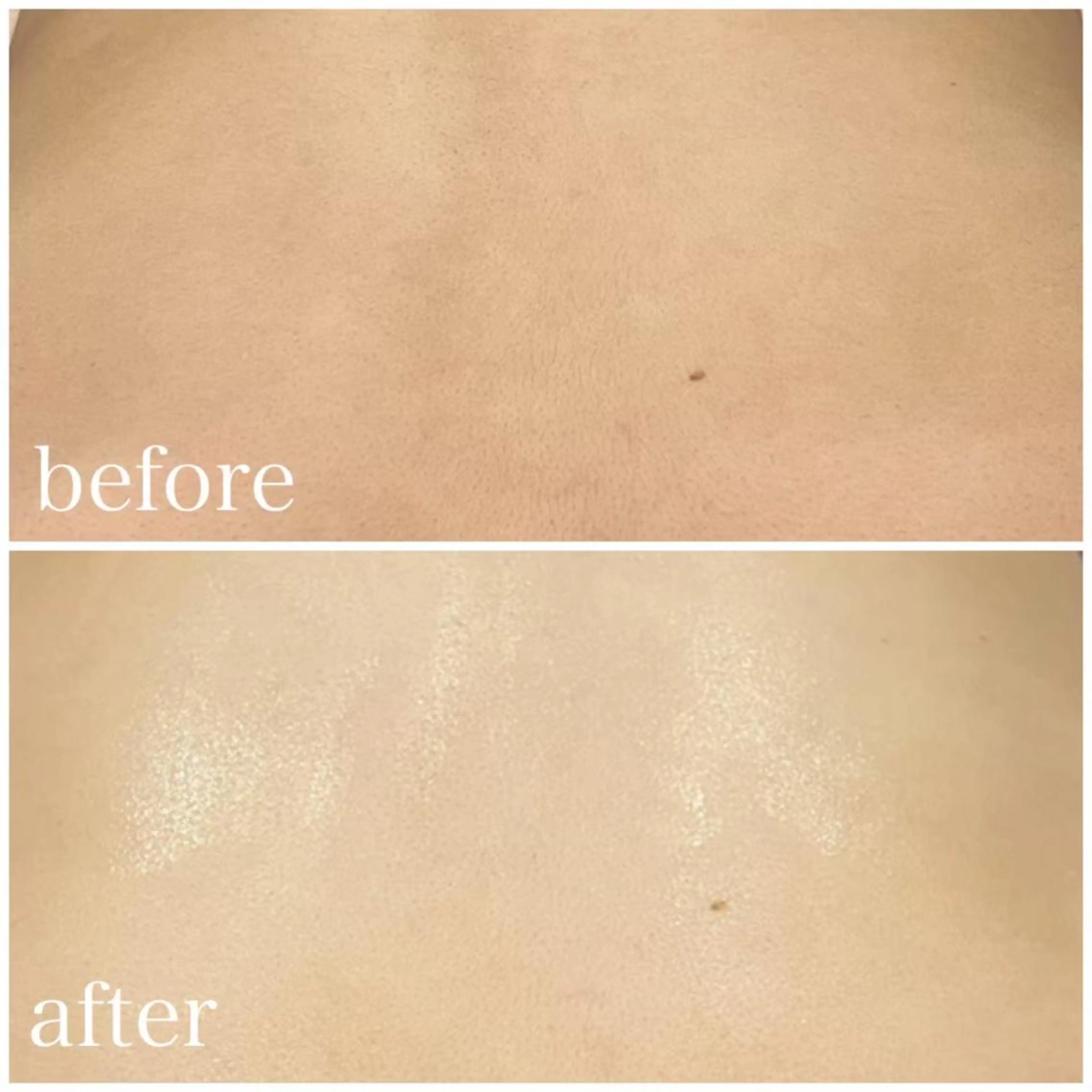 脱毛 ULULU上野店所属・ULULU 上野店のエステ・リラクイメージ