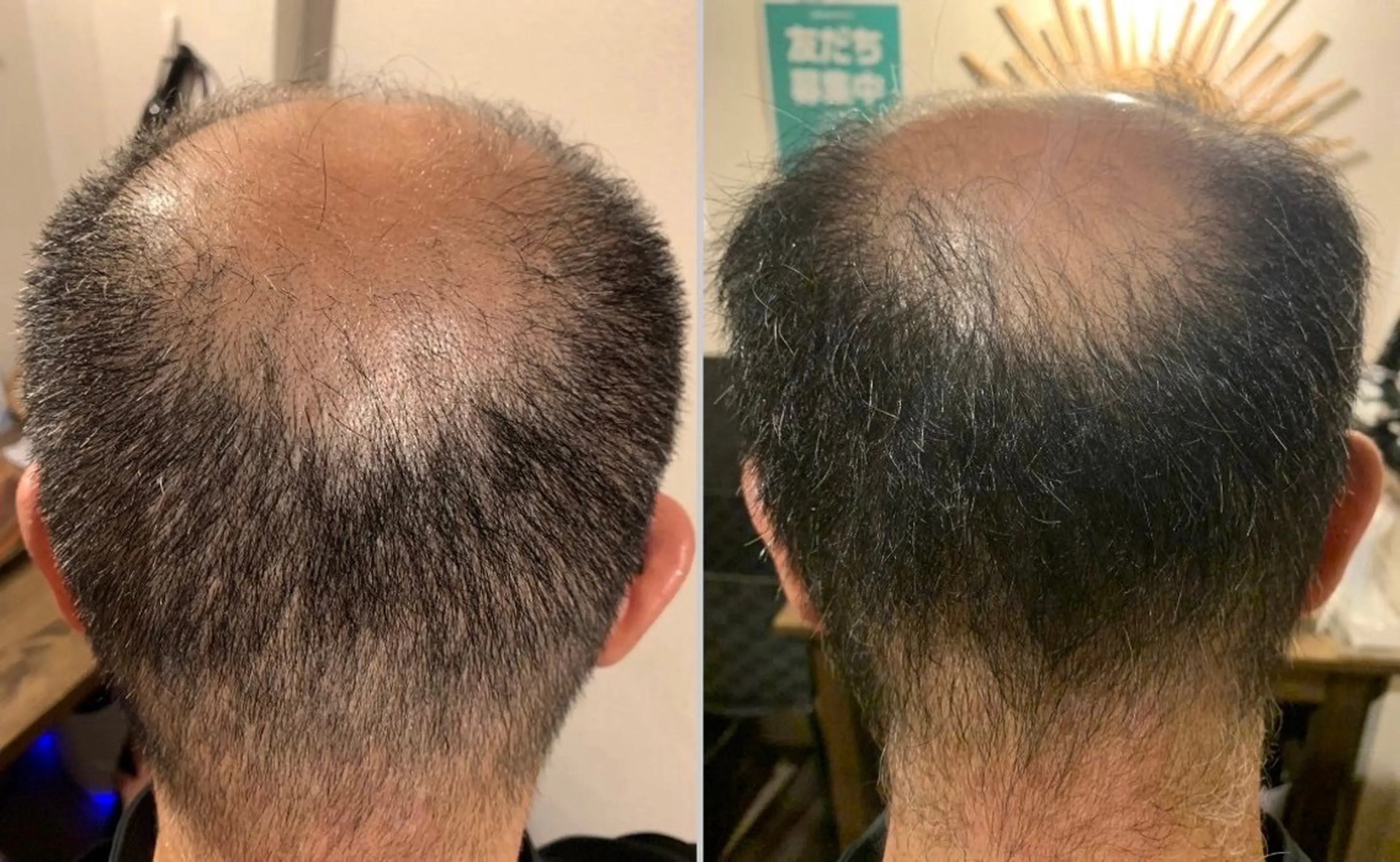 メンズ トリートメント ヘッドスパ 痩身・脱毛・美髪ケア 【GLYCINE】のエステ・リラクイメージ