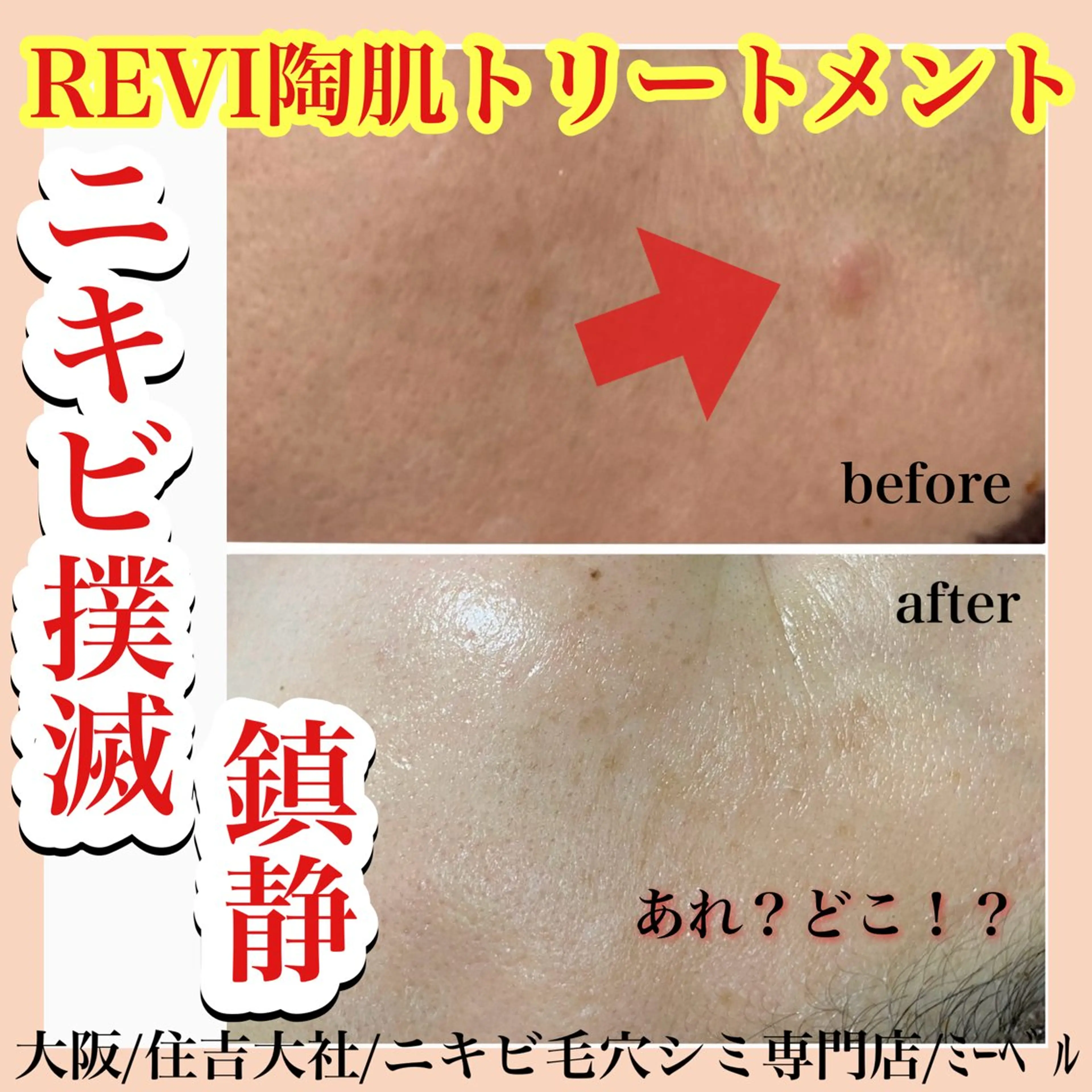 エステ salon  mebell所属・肌管理専門店 mebell天王寺店のエステ・リラクイメージ