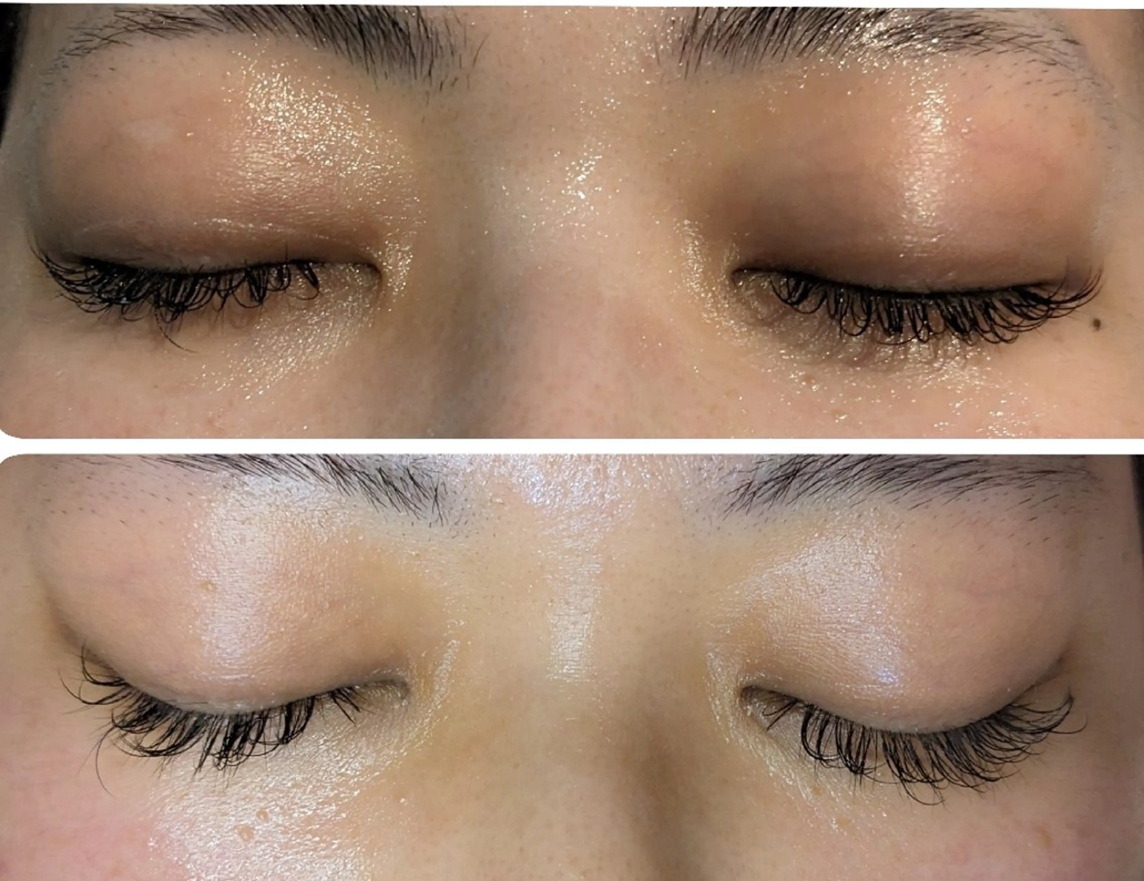 フェイシャル/毛穴 /シミ/たるみ東灘区のエステ・リラクイメージ