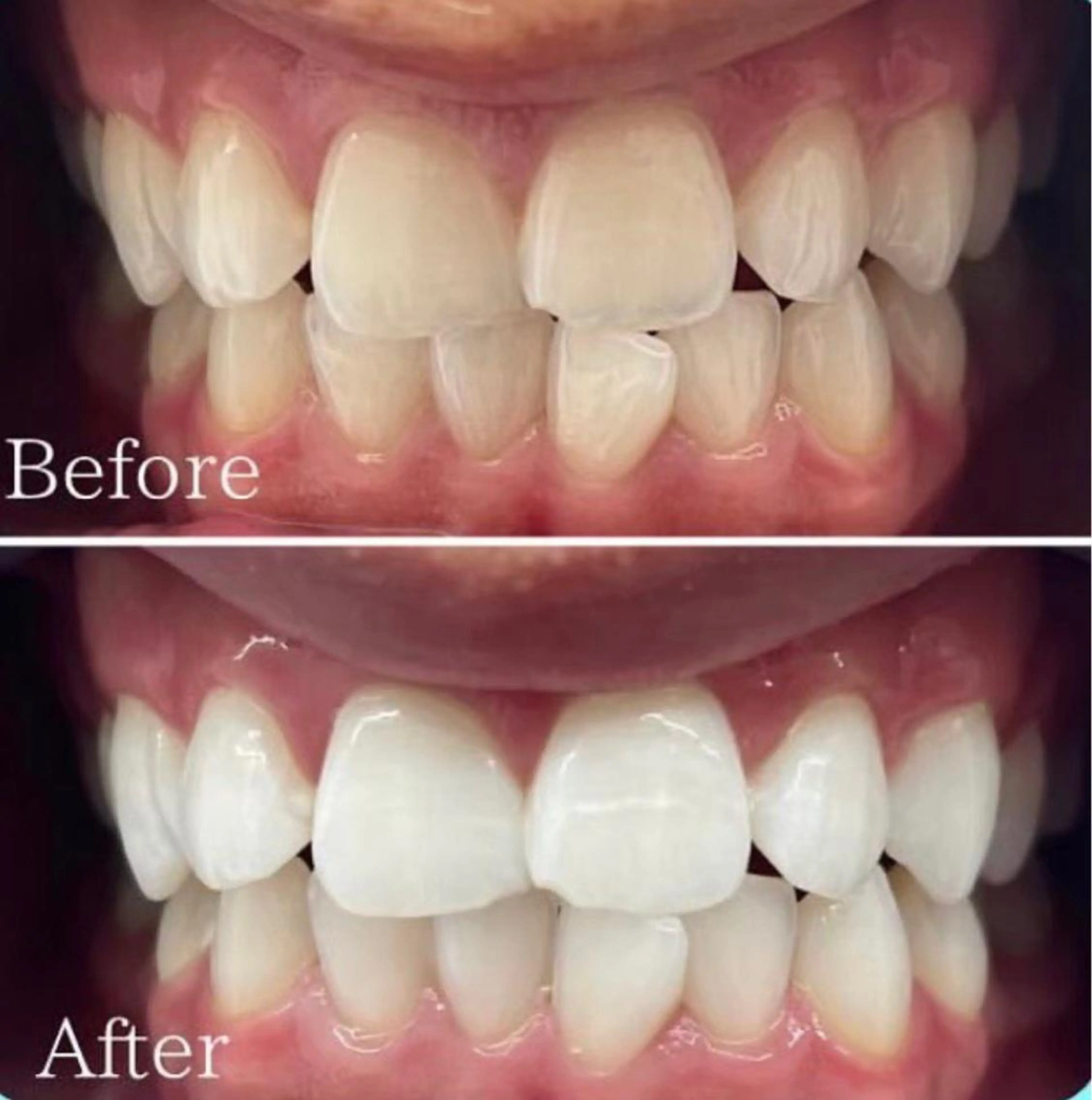 ホワイトニング専門店 WHITE天神店のエステ・リラクイメージ