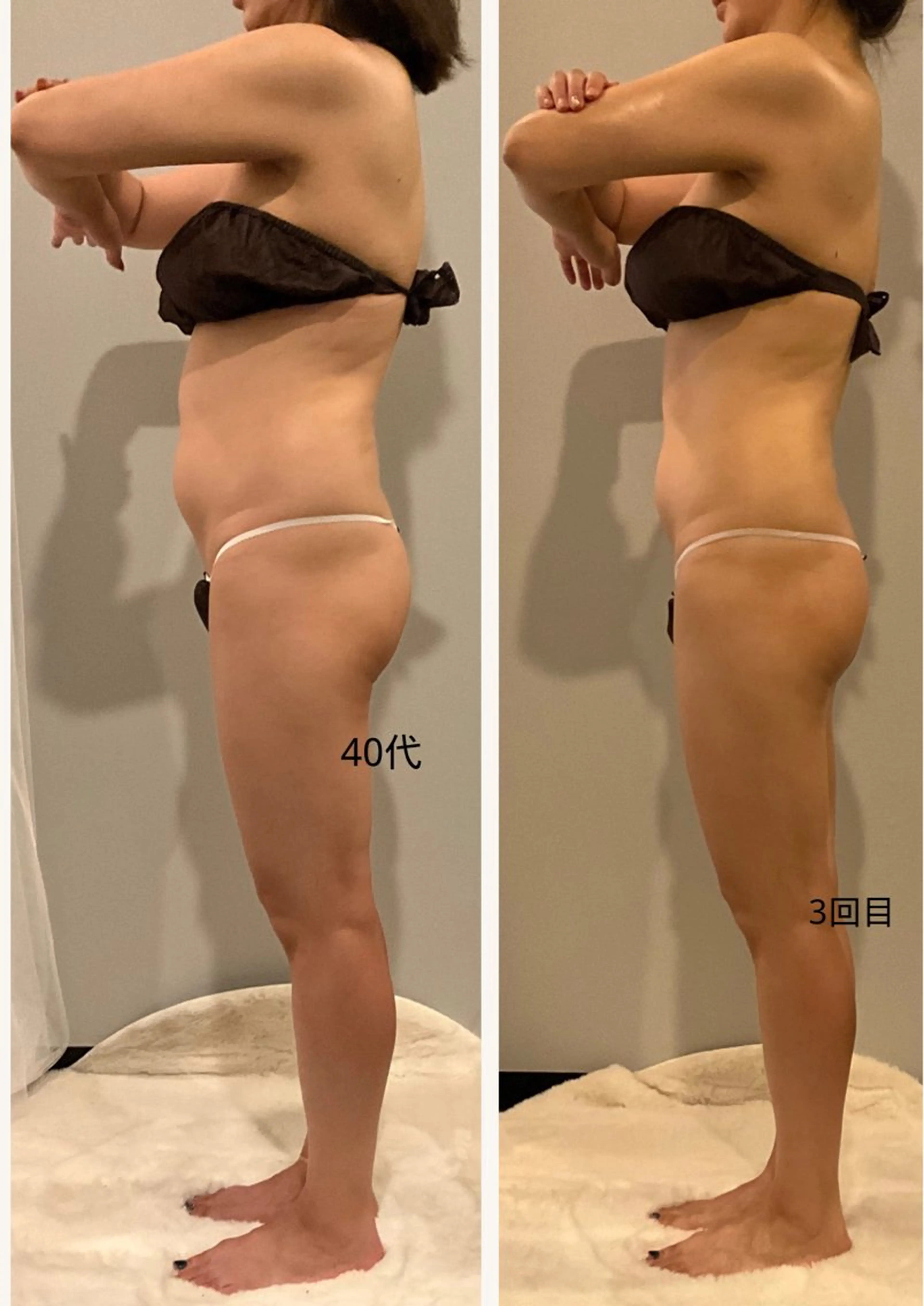 ✨痩身 ✨ハイパーナイフEXのエステ・リラクイメージ