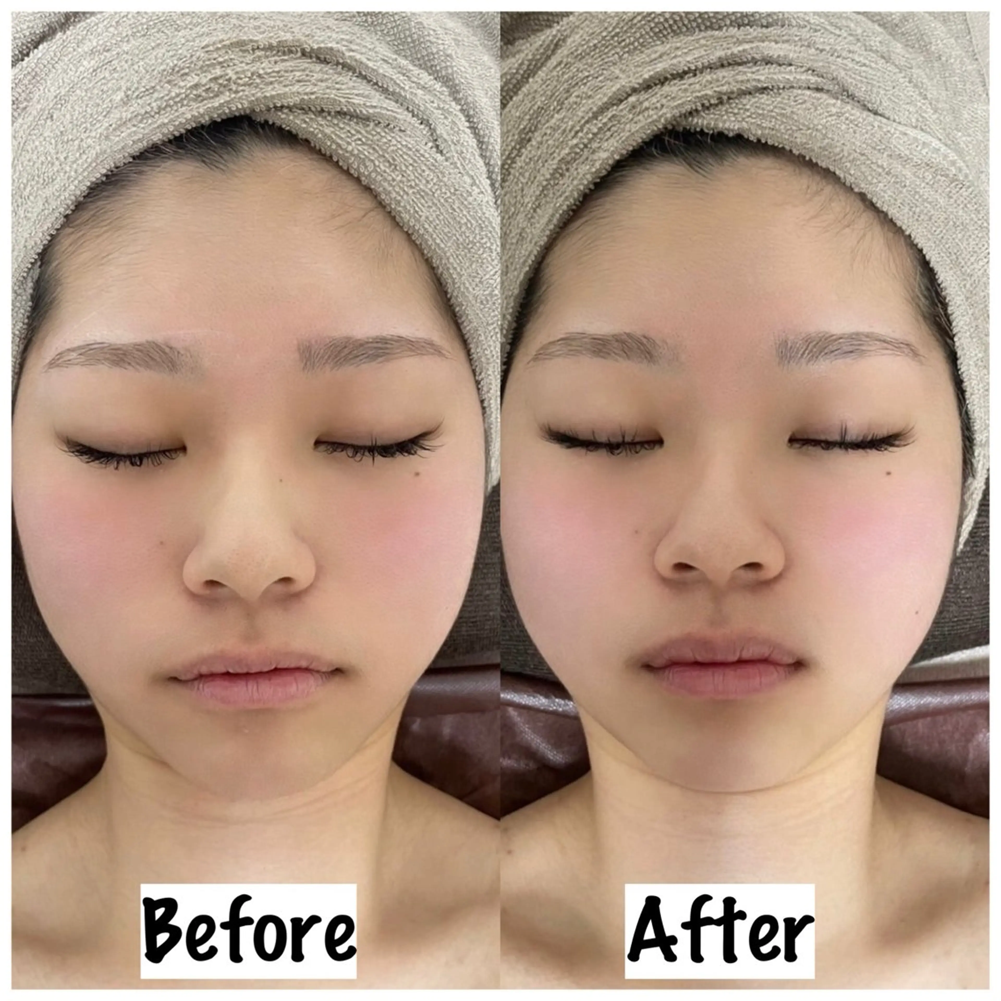 エステ リラク Loar 【痩身/小顔エステサロン】所属・Loar エステ中野 絵里奈のエステ・リラクイメージ