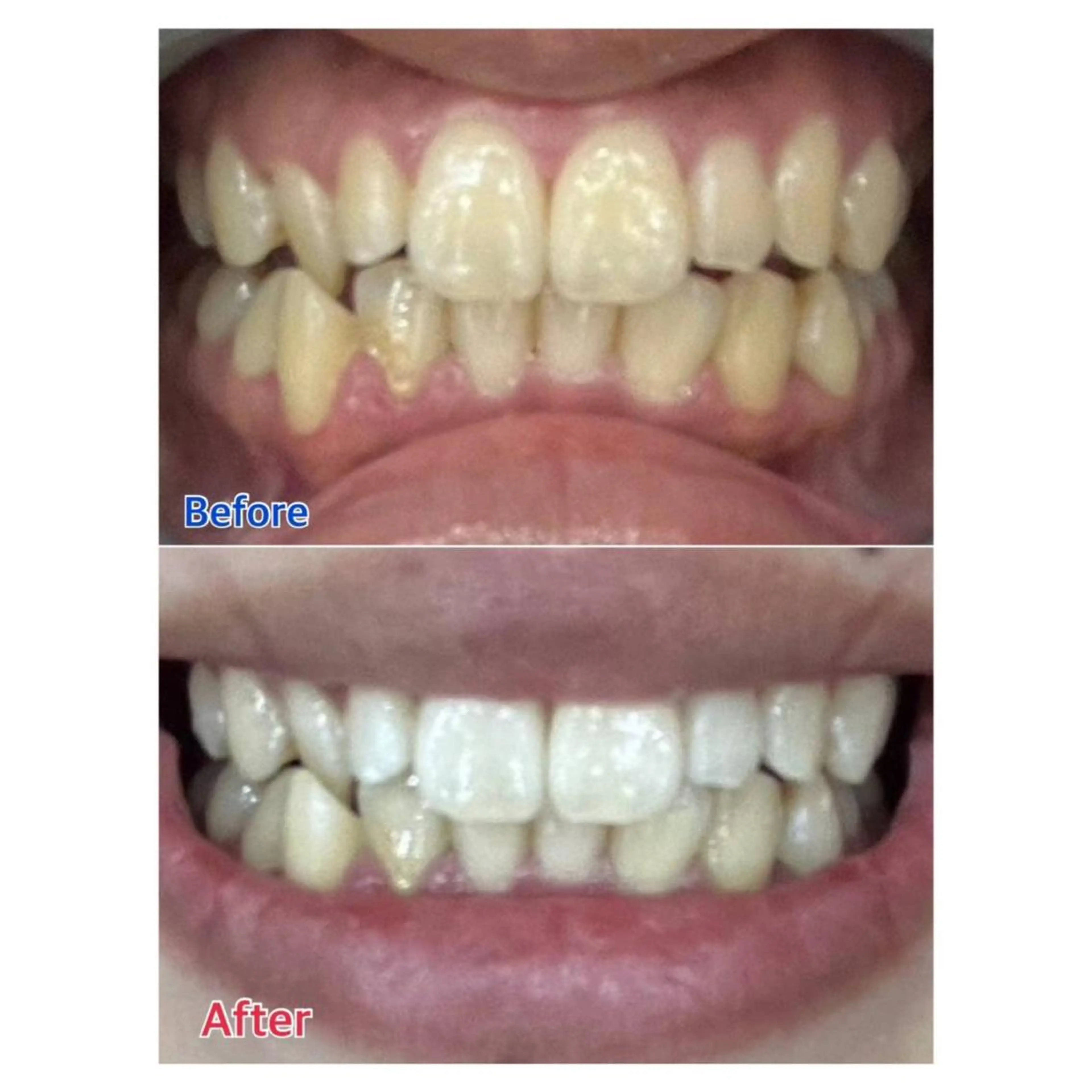 MBEAUTYSALON 千葉店・京成大久保所属・Melty 輝のその他イメージ