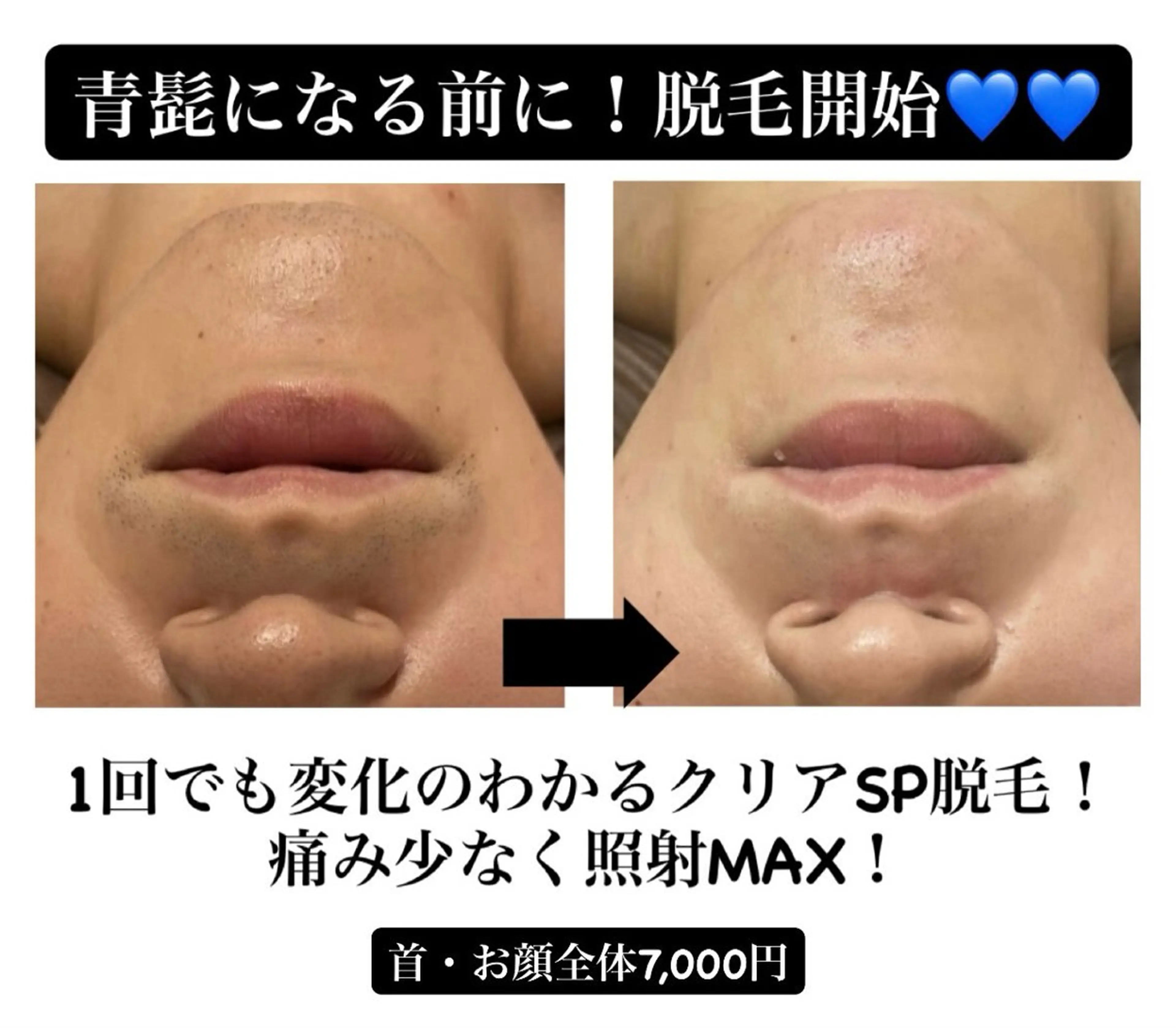 メンズ 脱毛 DECIDE L.A.W所属・太田 女久美のエステ・リラクイメージ