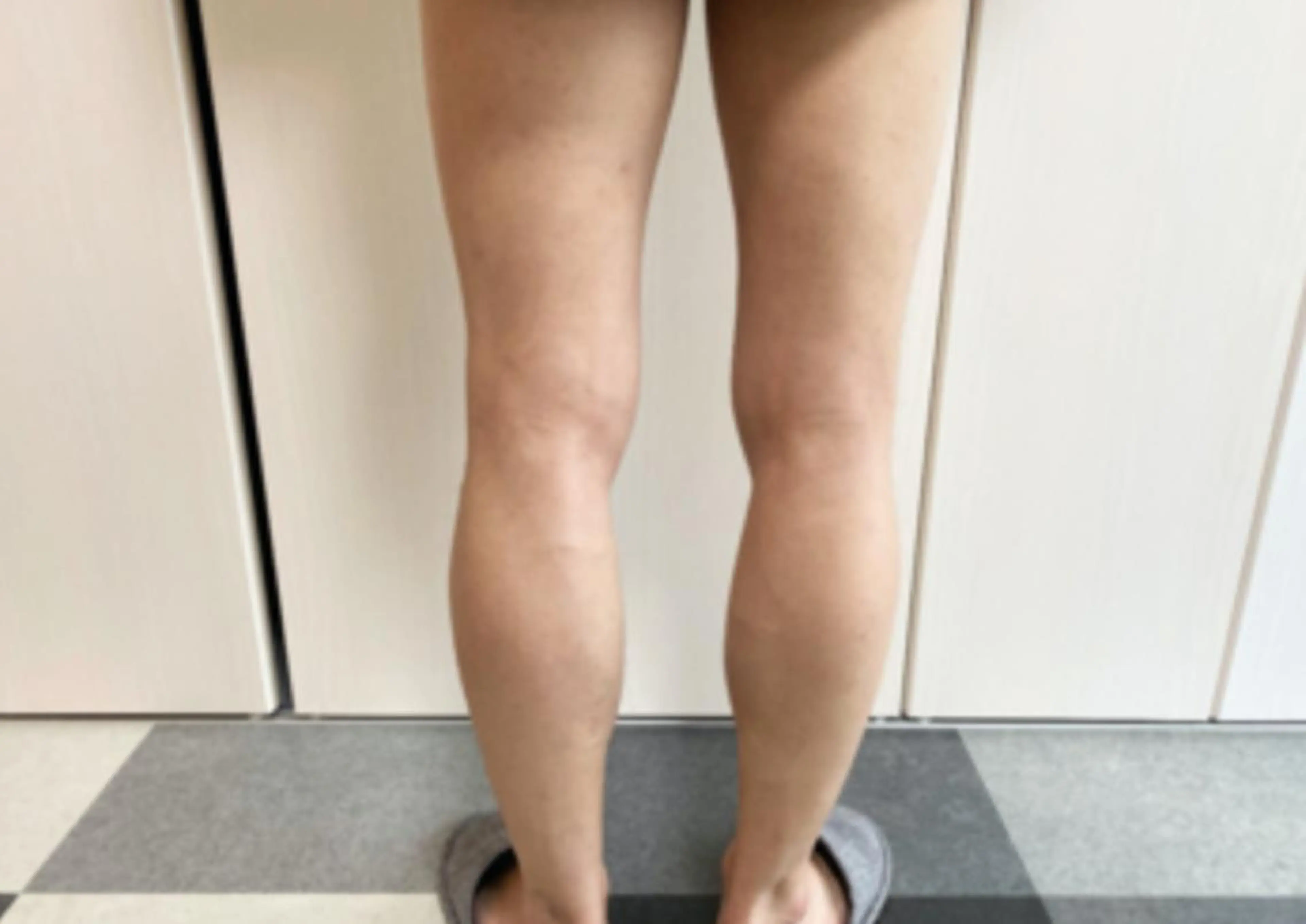 ATRIUM　 HOMMEのエステ・リラクイメージ