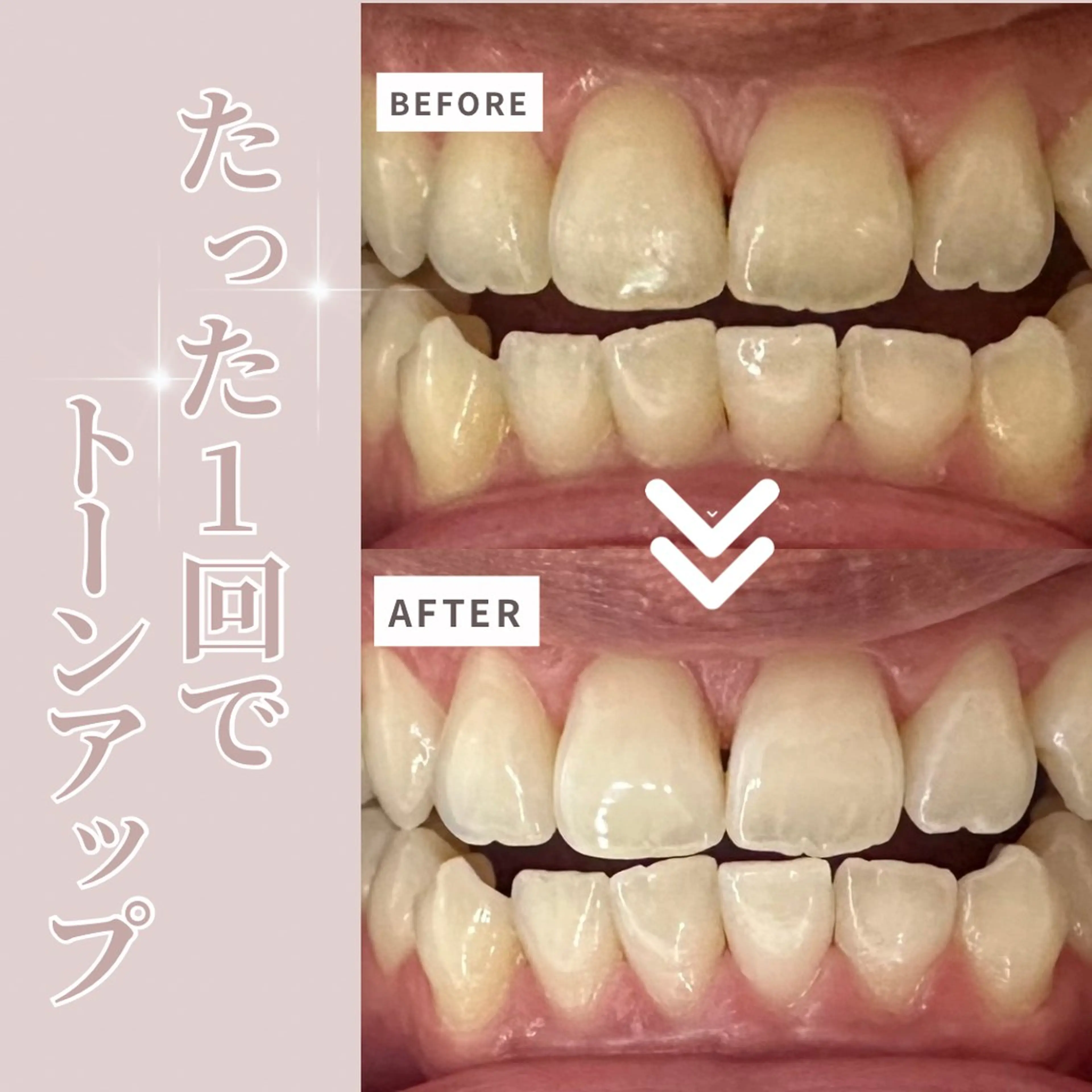 LIBRA自由が丘所属・LIBRA自由が丘 ホワイトニングのその他イメージ